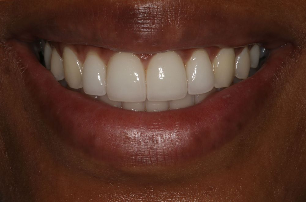 Georgetown Cosmetic Dentistry