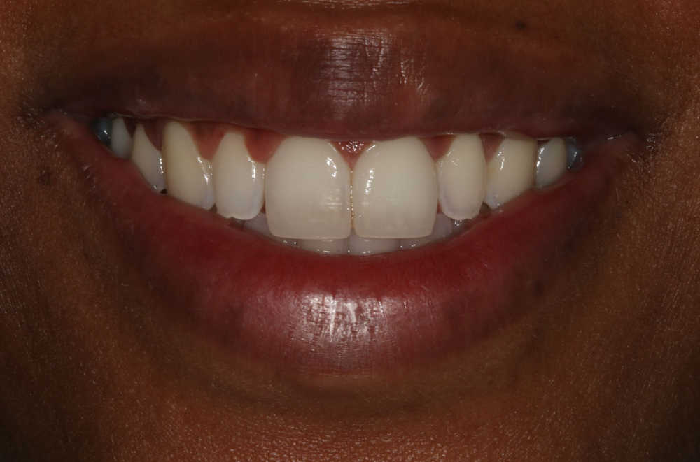 Georgetown Cosmetic Dentistry
