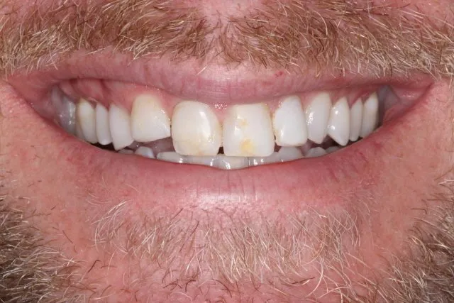 Georgetown Cosmetic Dentistry