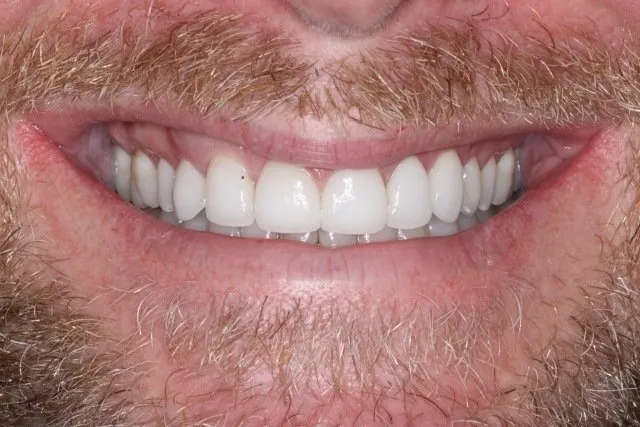 Georgetown Cosmetic Dentistry