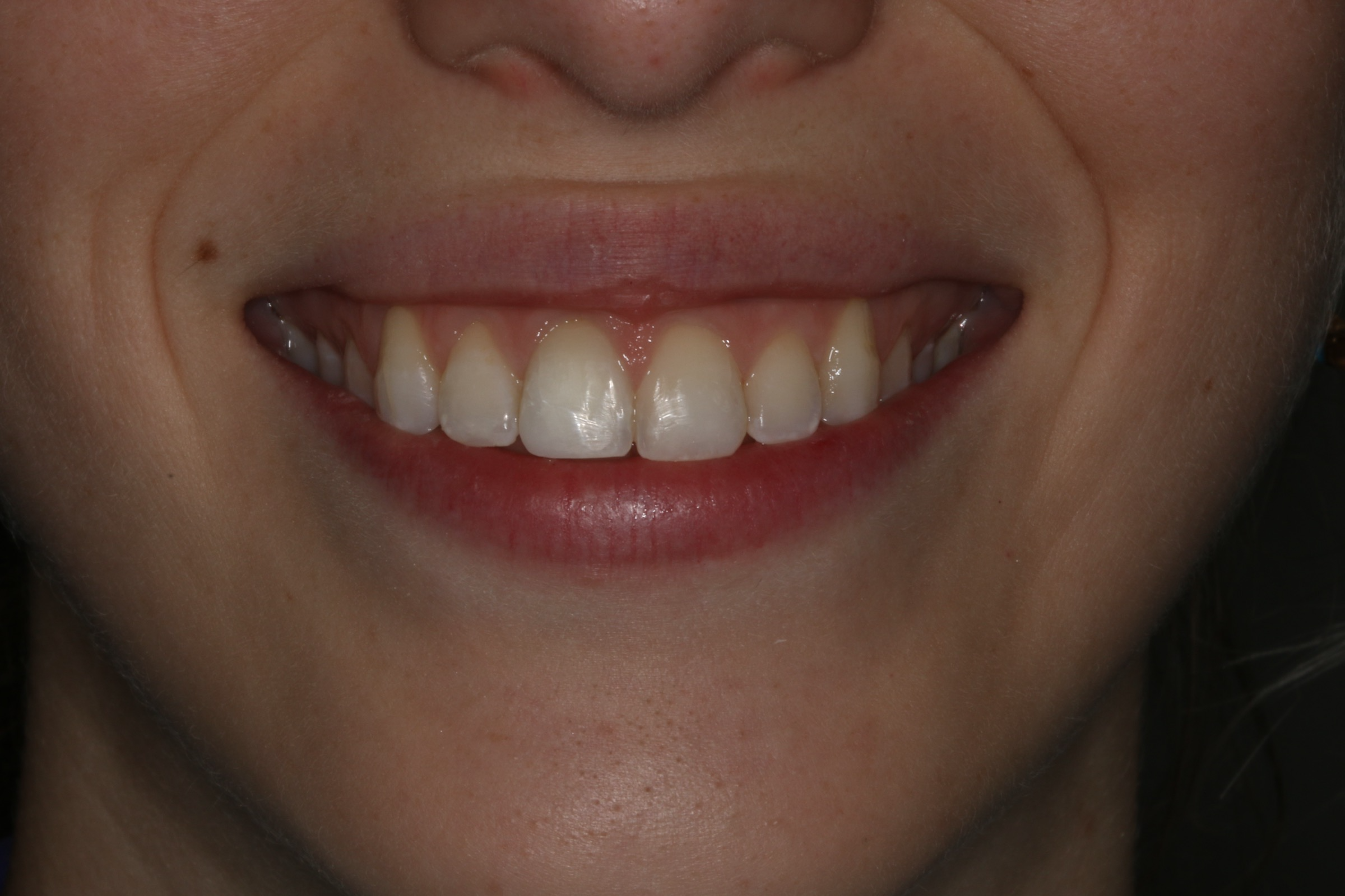 Georgetown Cosmetic Dentistry