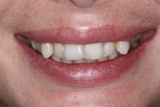 Georgetown Cosmetic Dentistry