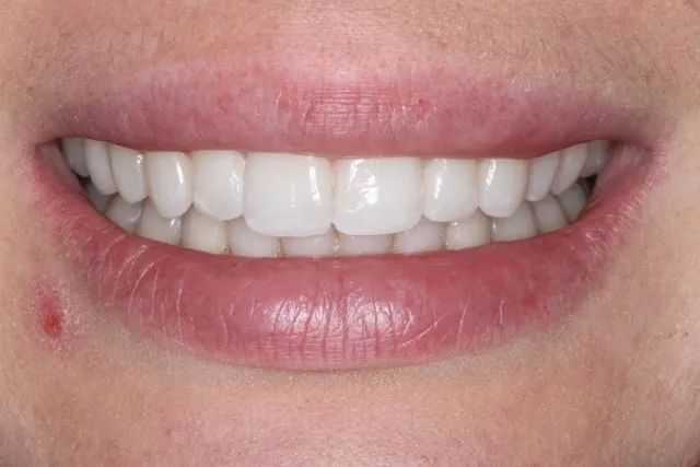 Georgetown Cosmetic Dentistry