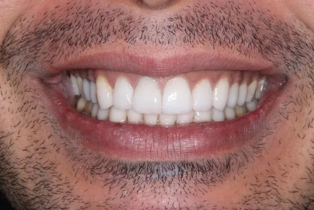 Georgetown Cosmetic Dentistry