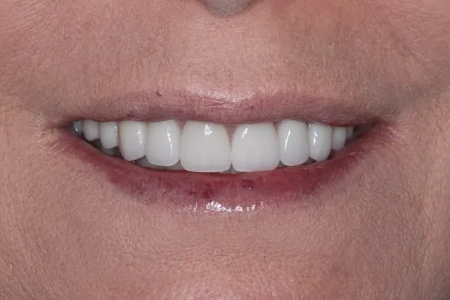 Georgetown Cosmetic Dentistry