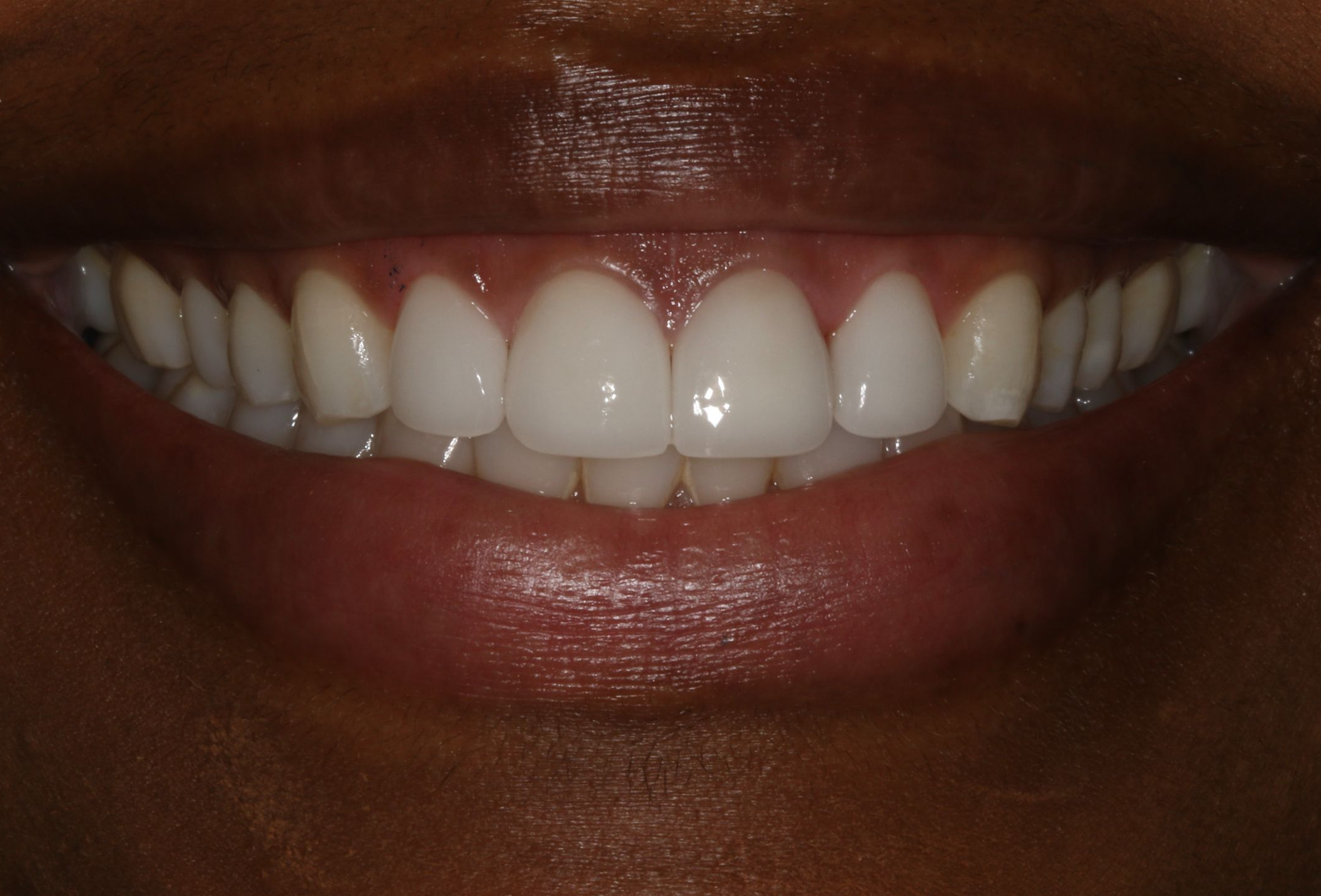 Georgetown Cosmetic Dentistry