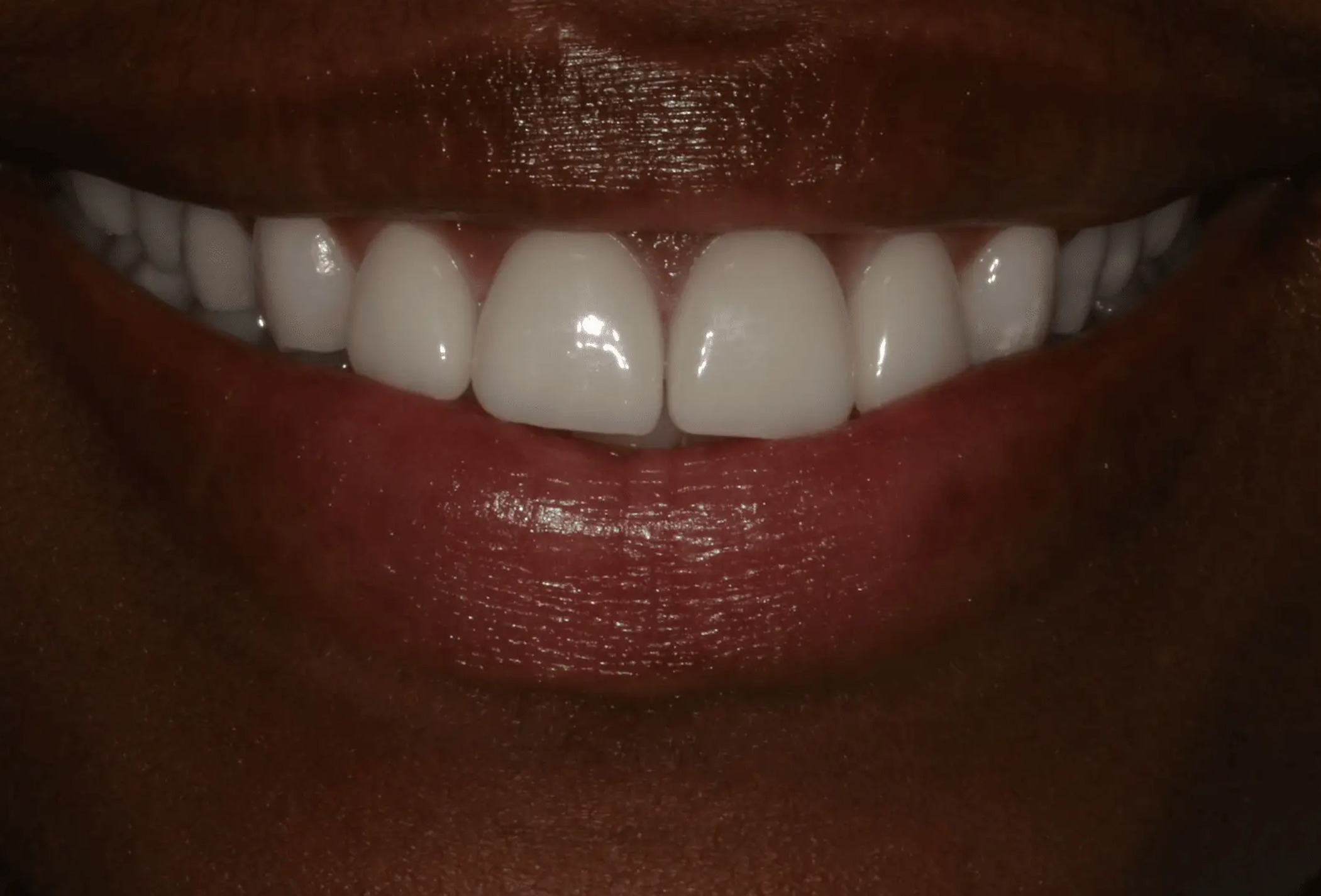 Georgetown Cosmetic Dentistry