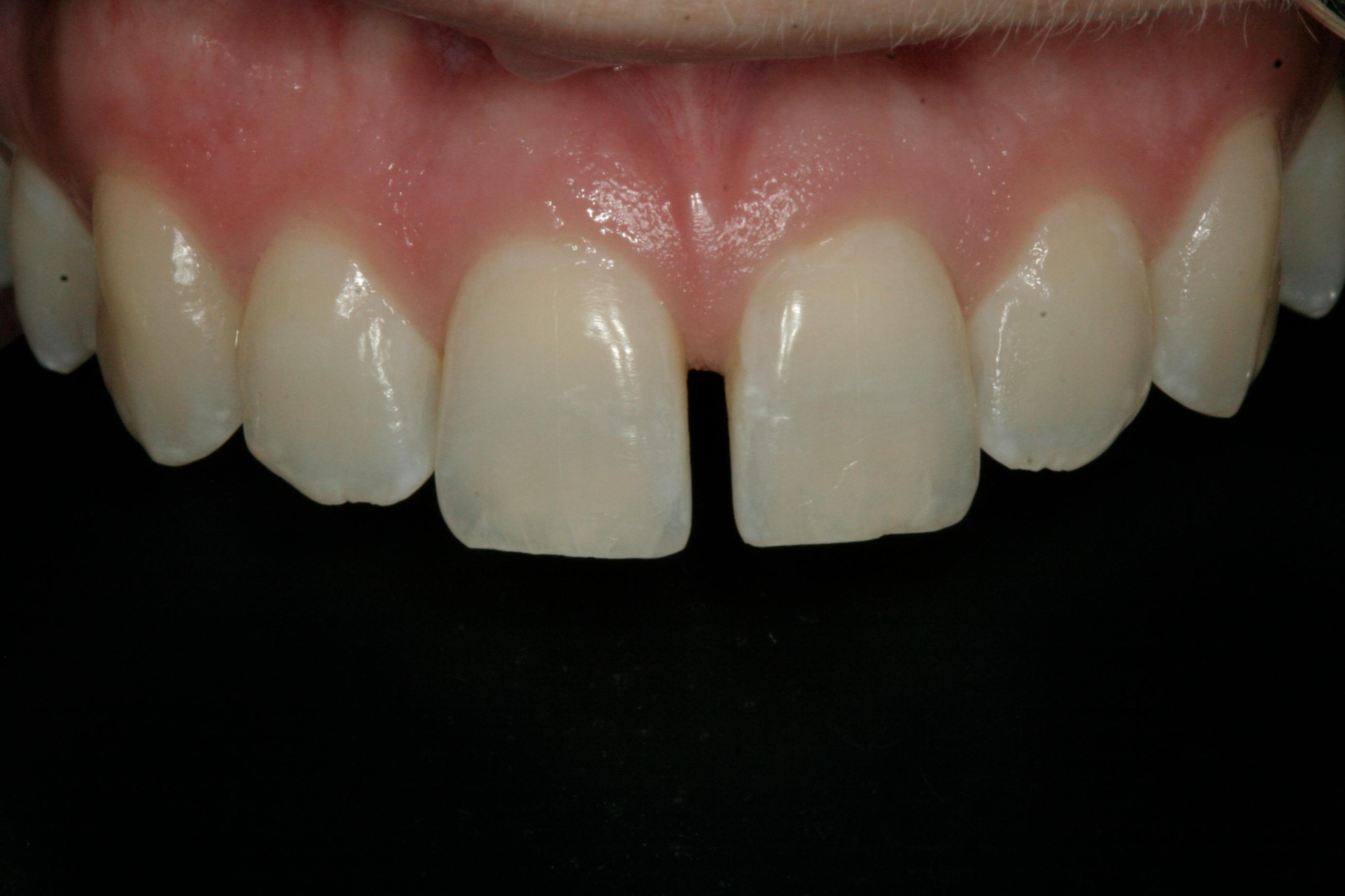 Georgetown Cosmetic Dentistry