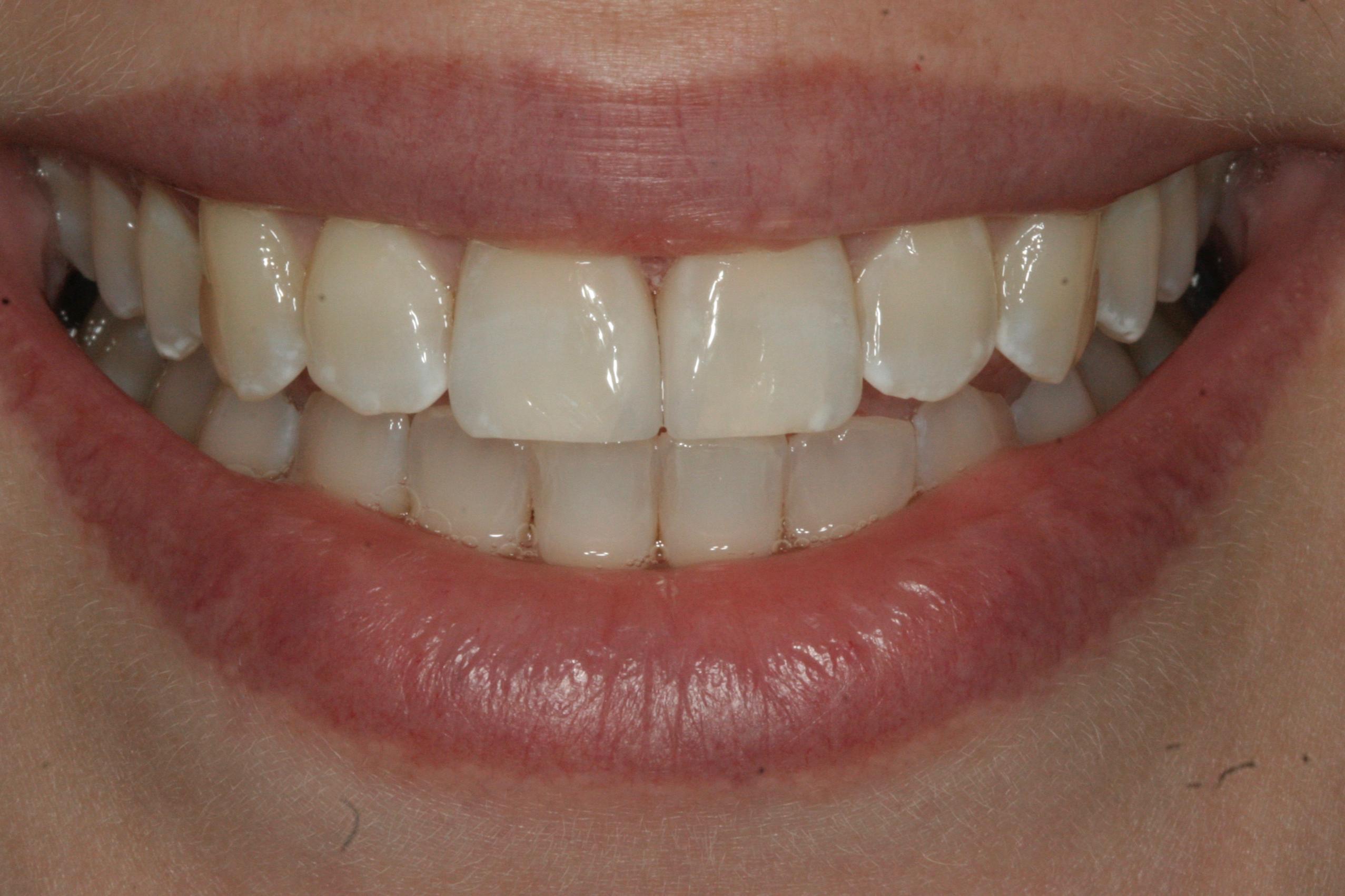 Georgetown Cosmetic Dentistry