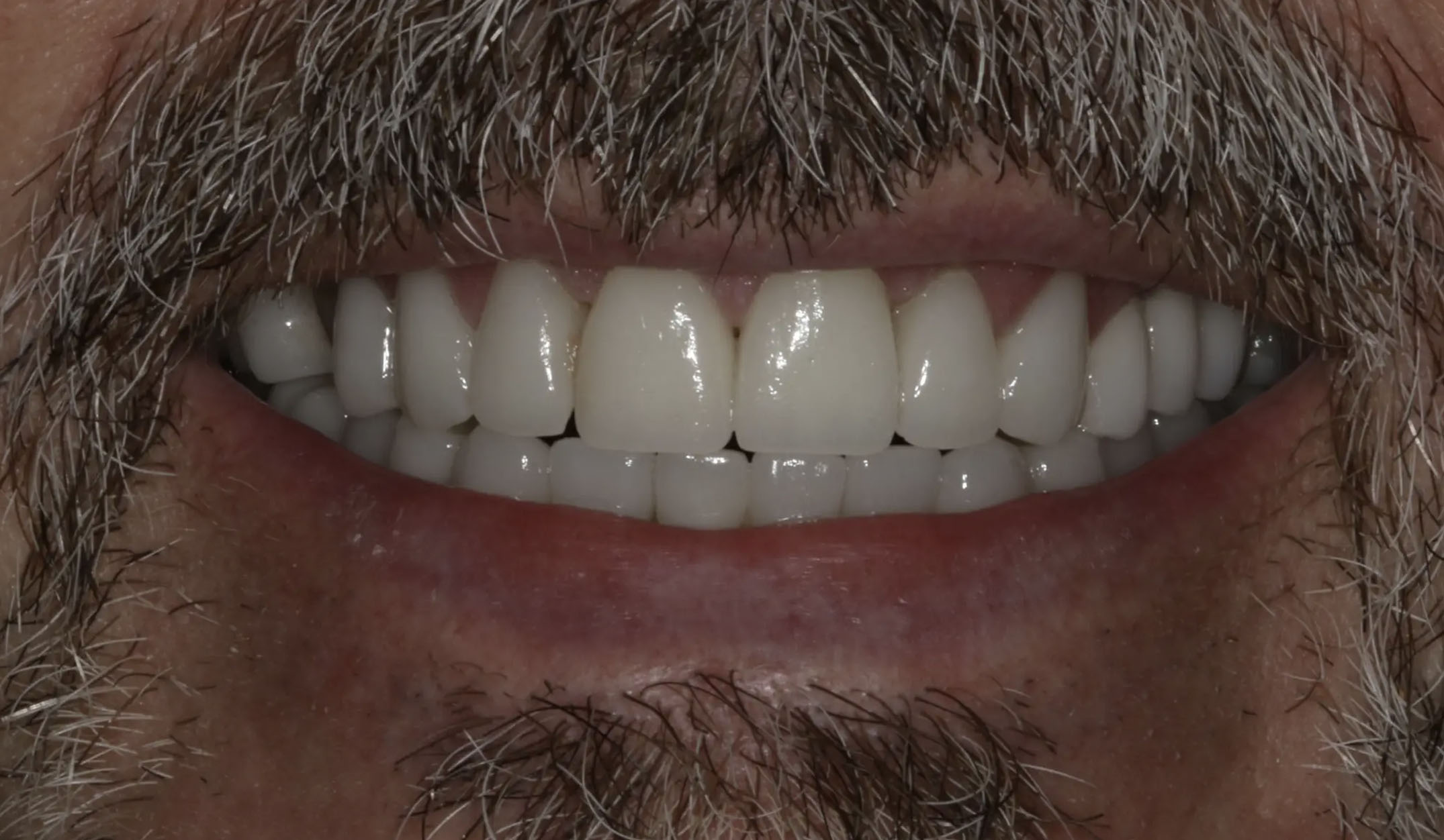 Georgetown Cosmetic Dentistry