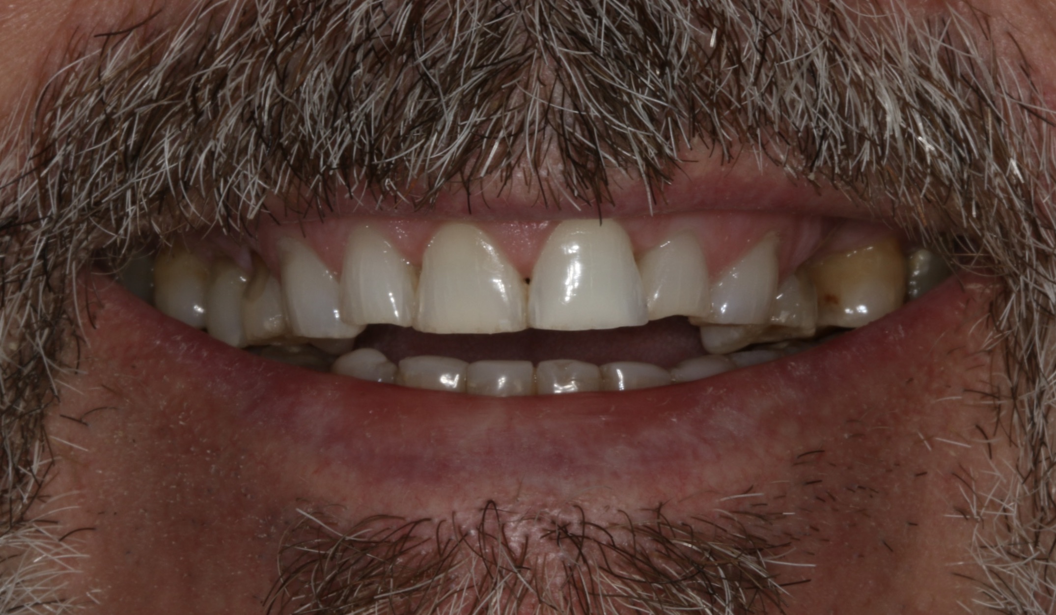 Georgetown Cosmetic Dentistry