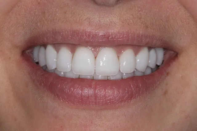 Georgetown Cosmetic Dentistry