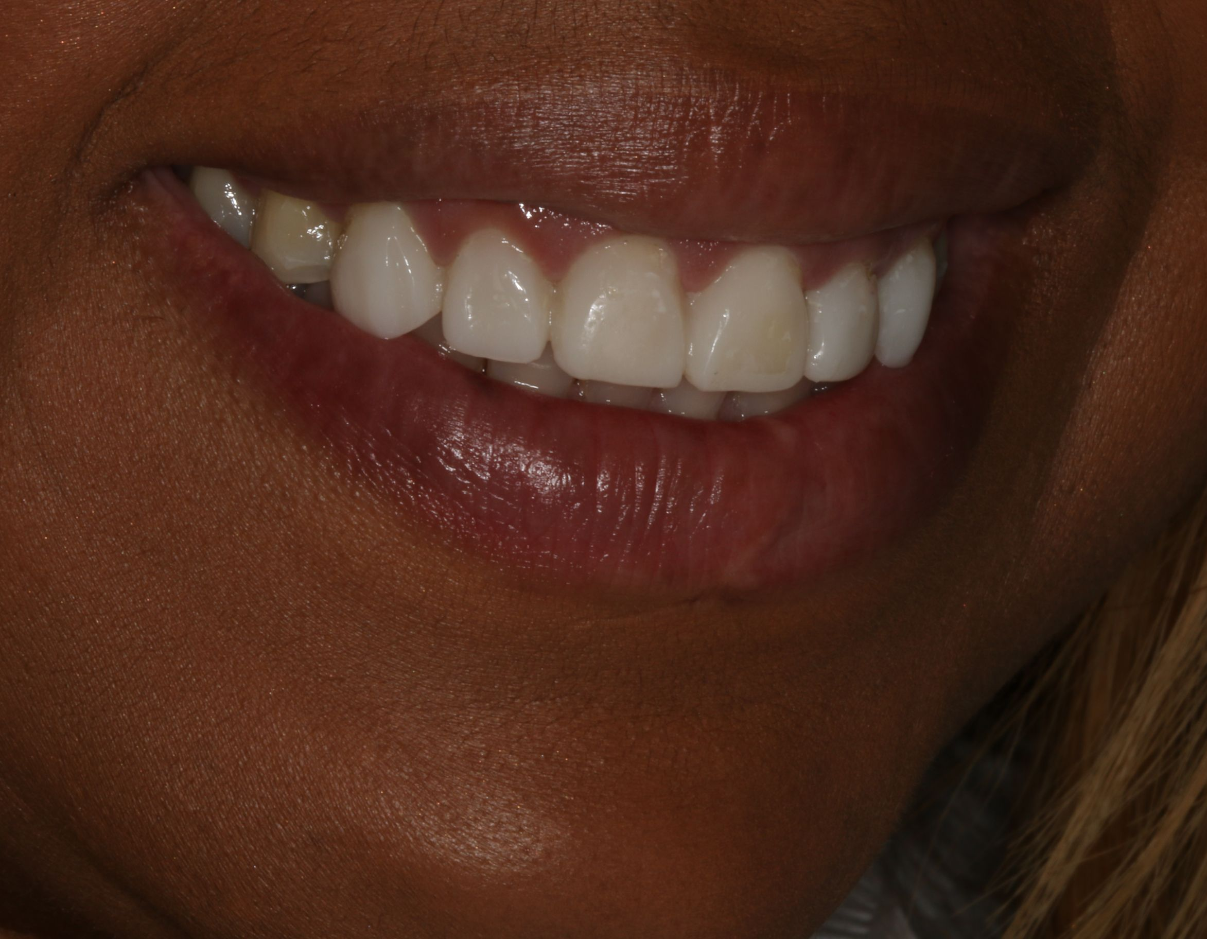 Georgetown Cosmetic Dentistry