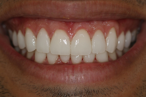 Georgetown Cosmetic Dentistry