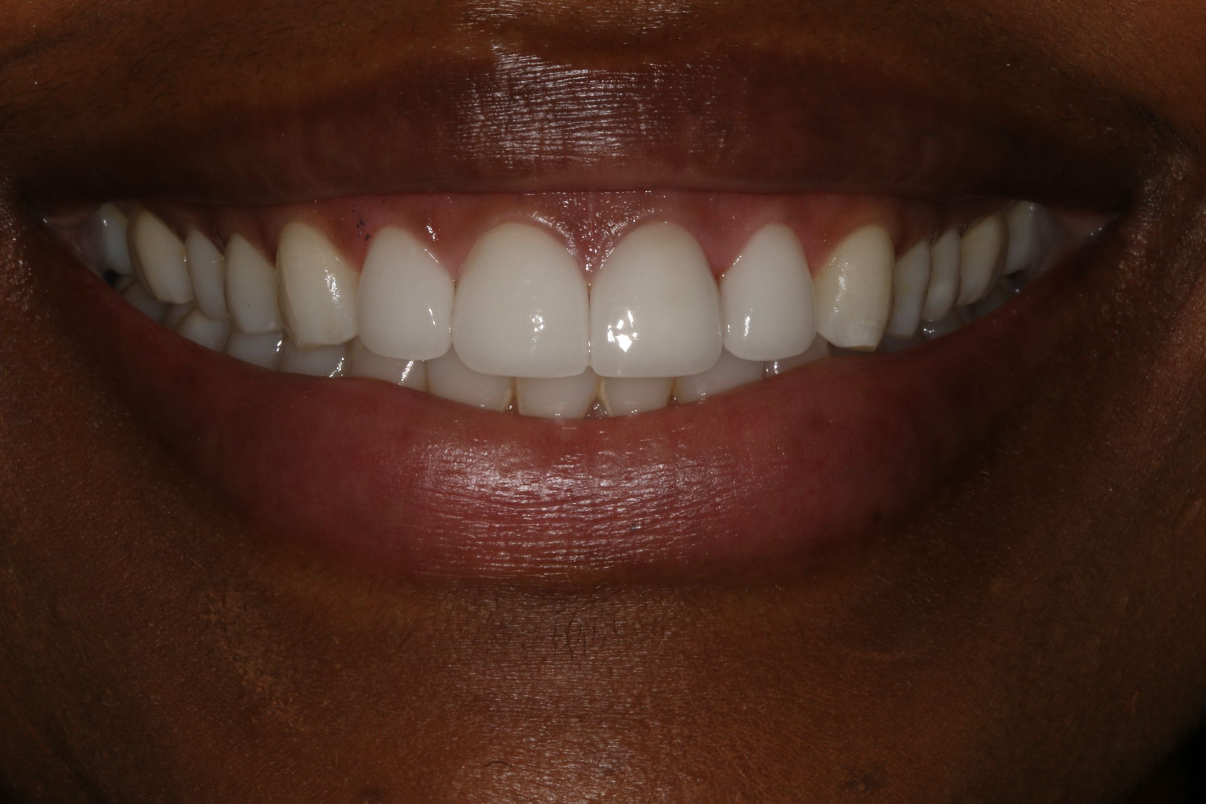 Georgetown Cosmetic Dentistry