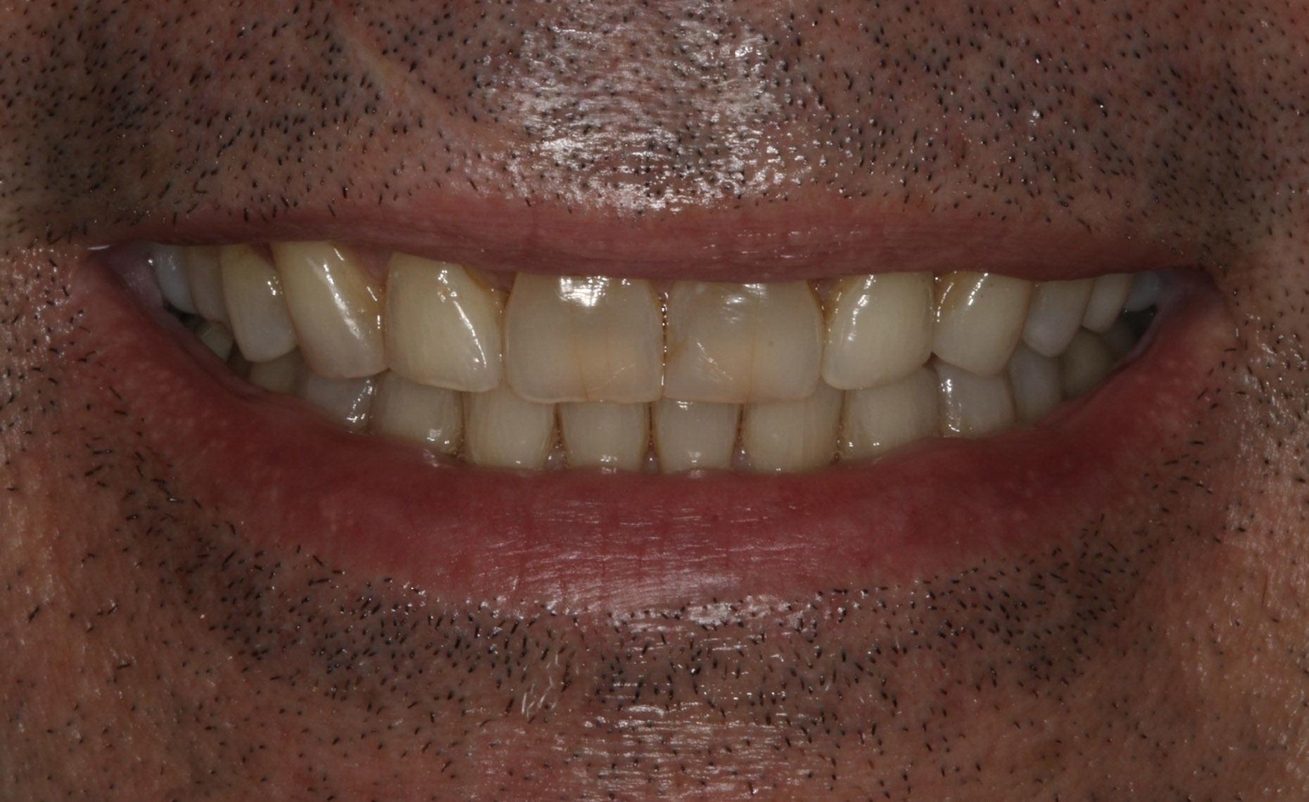 Georgetown Cosmetic Dentistry