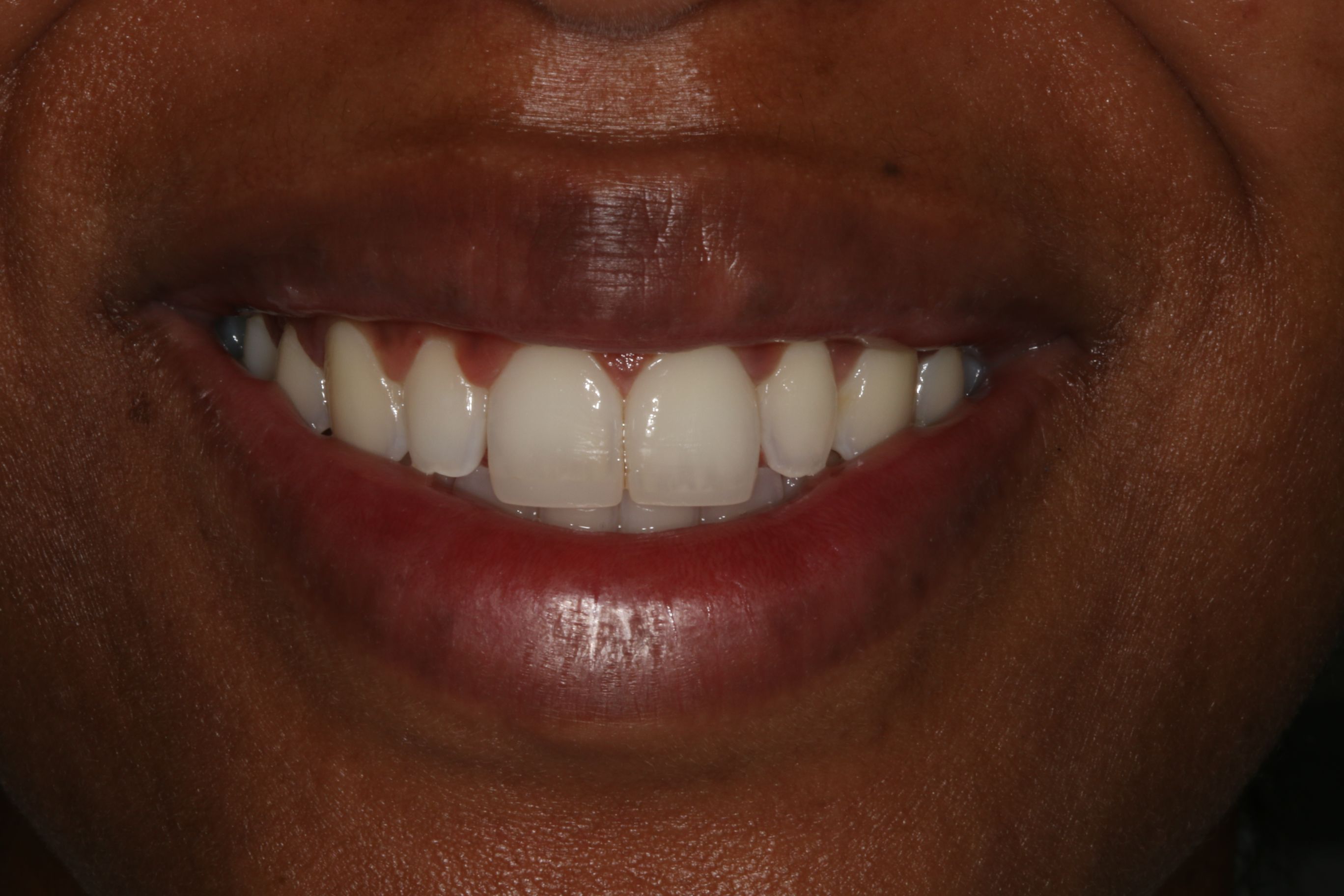 Georgetown Cosmetic Dentistry