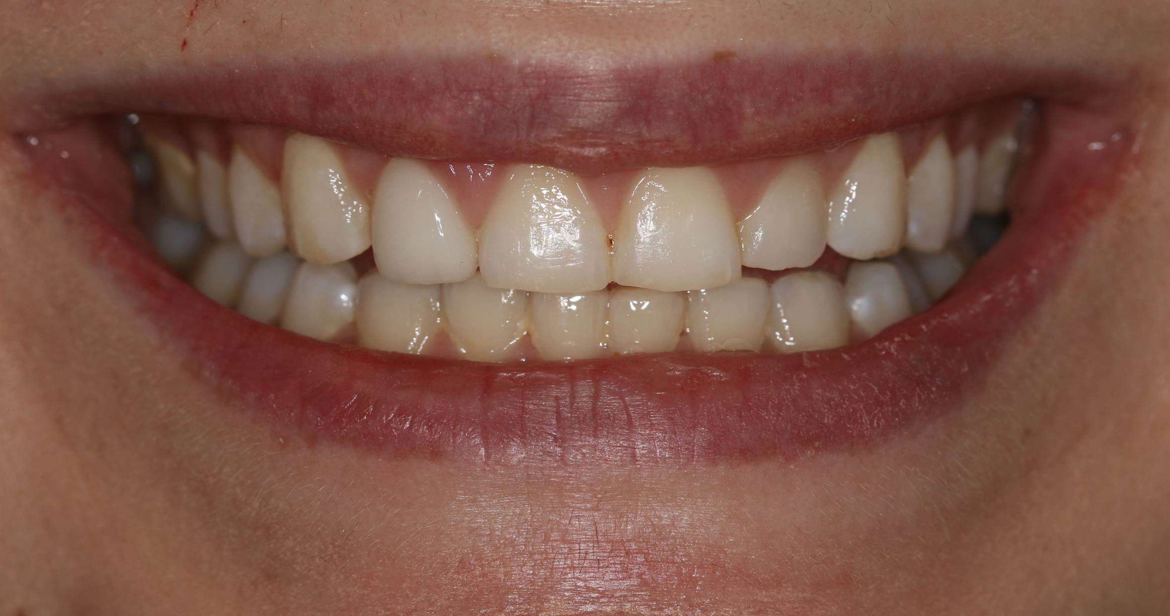 Georgetown Cosmetic Dentistry