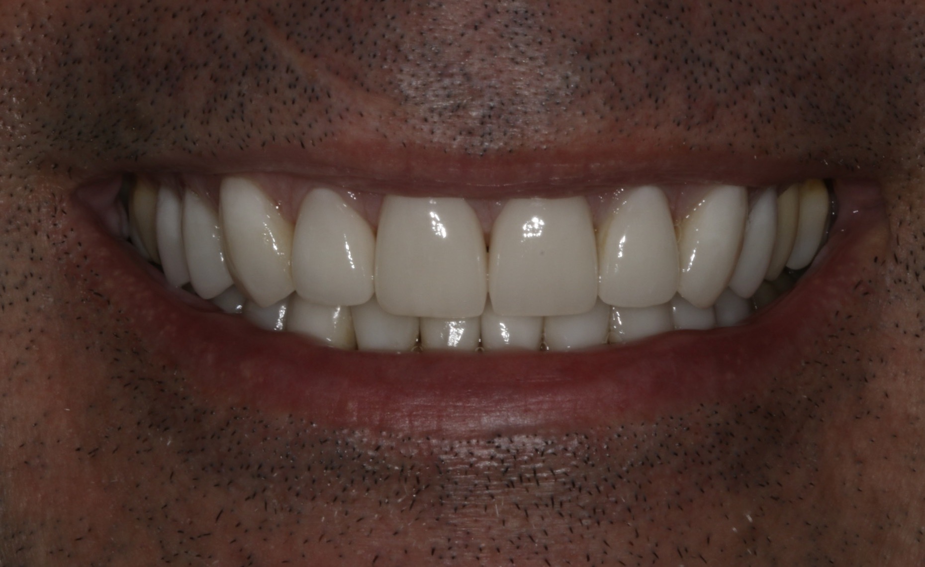 Georgetown Cosmetic Dentistry