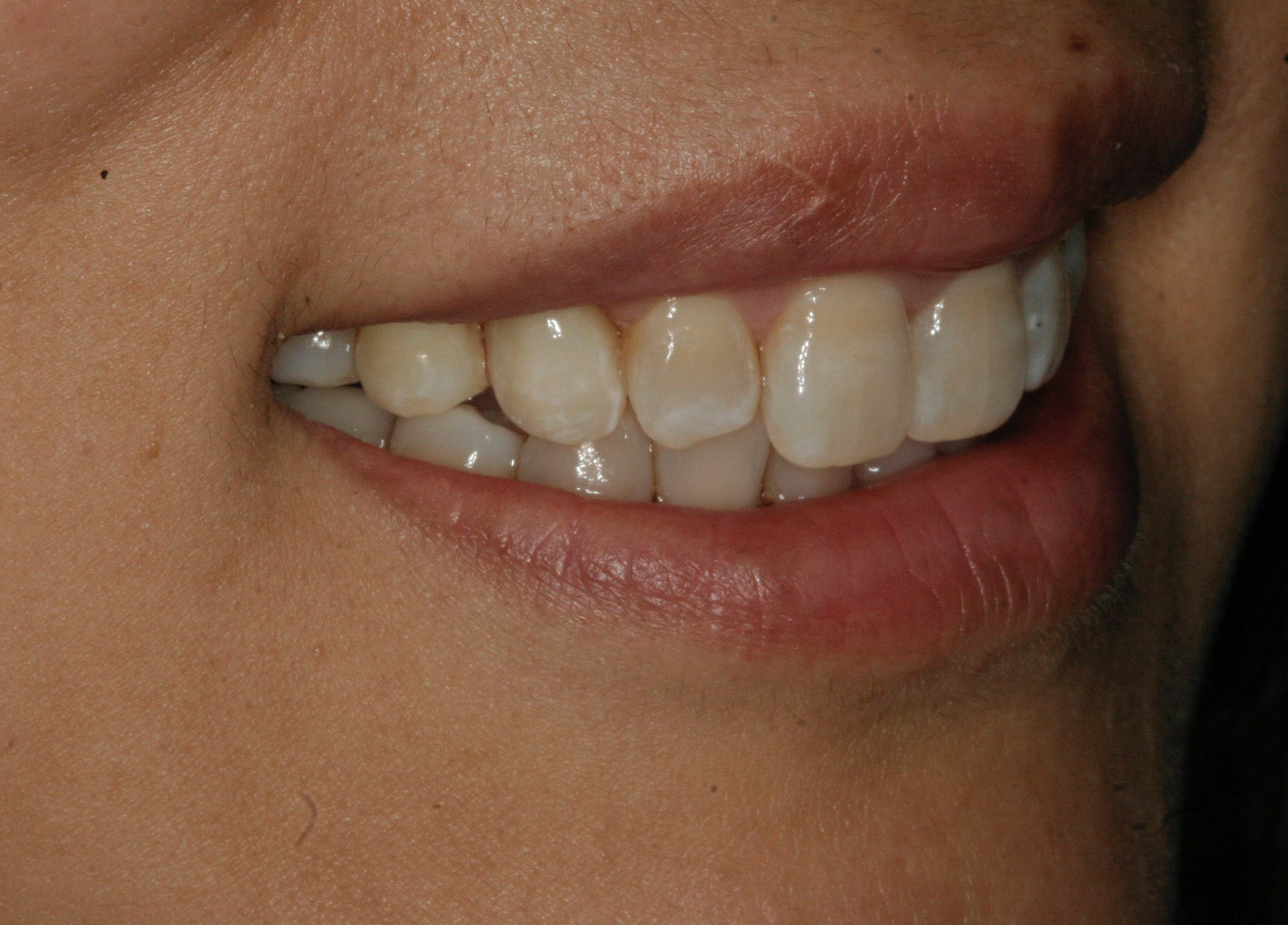 Georgetown Cosmetic Dentistry