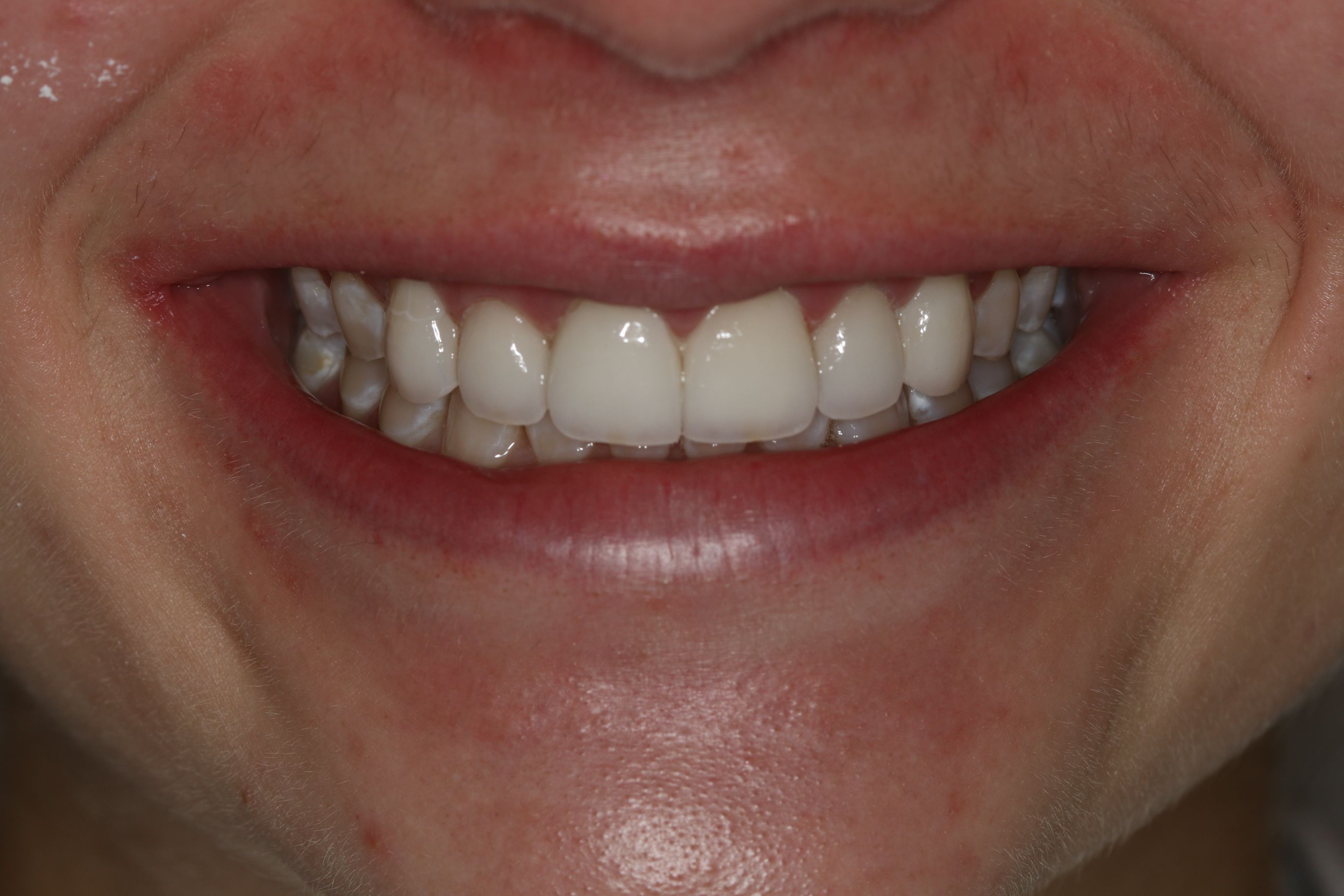 Georgetown Cosmetic Dentistry