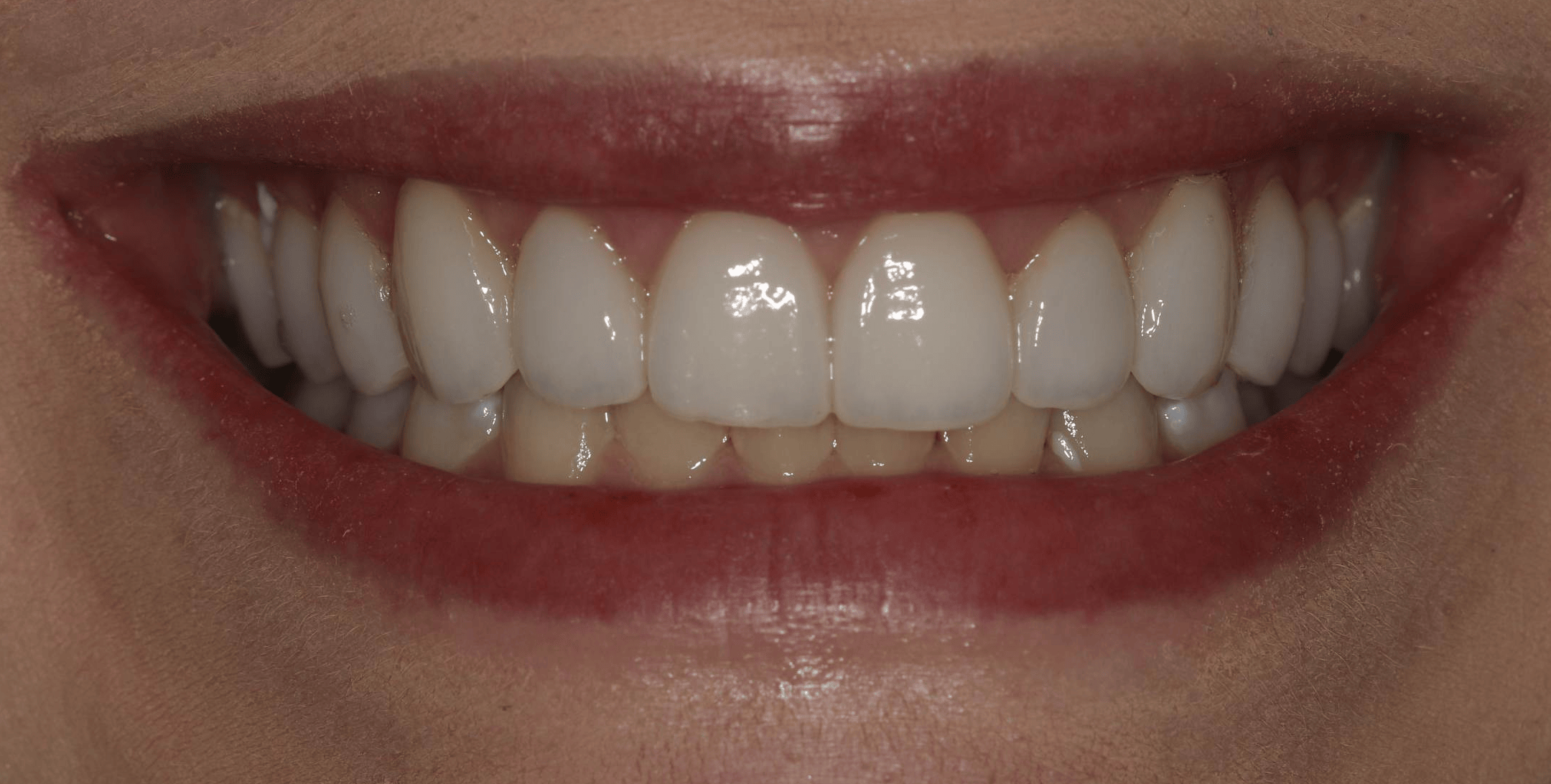 Georgetown Cosmetic Dentistry