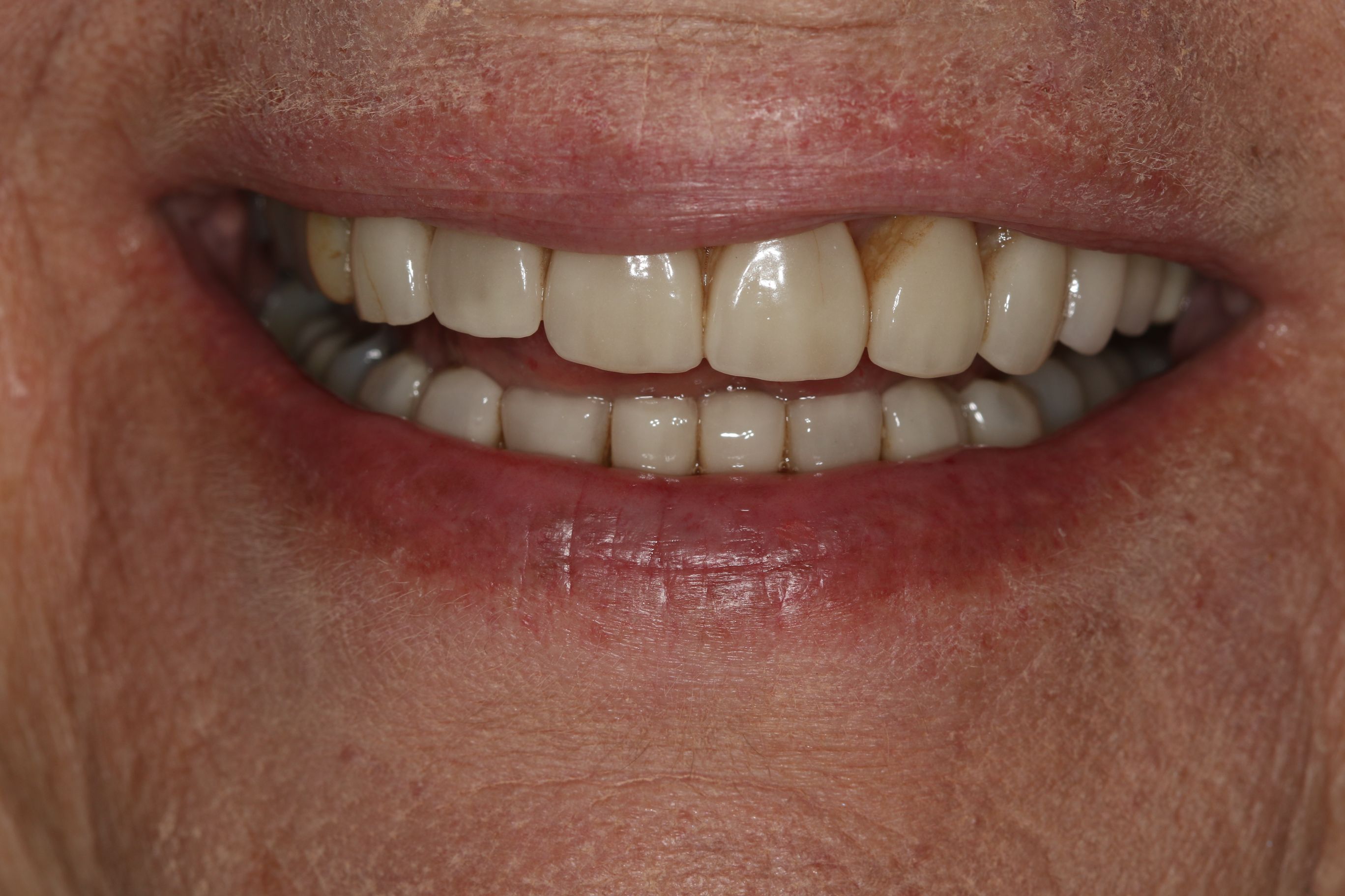 Georgetown Cosmetic Dentistry