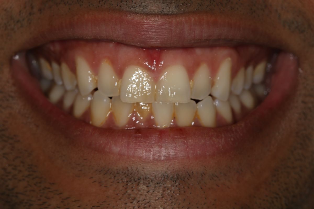 Georgetown Cosmetic Dentistry