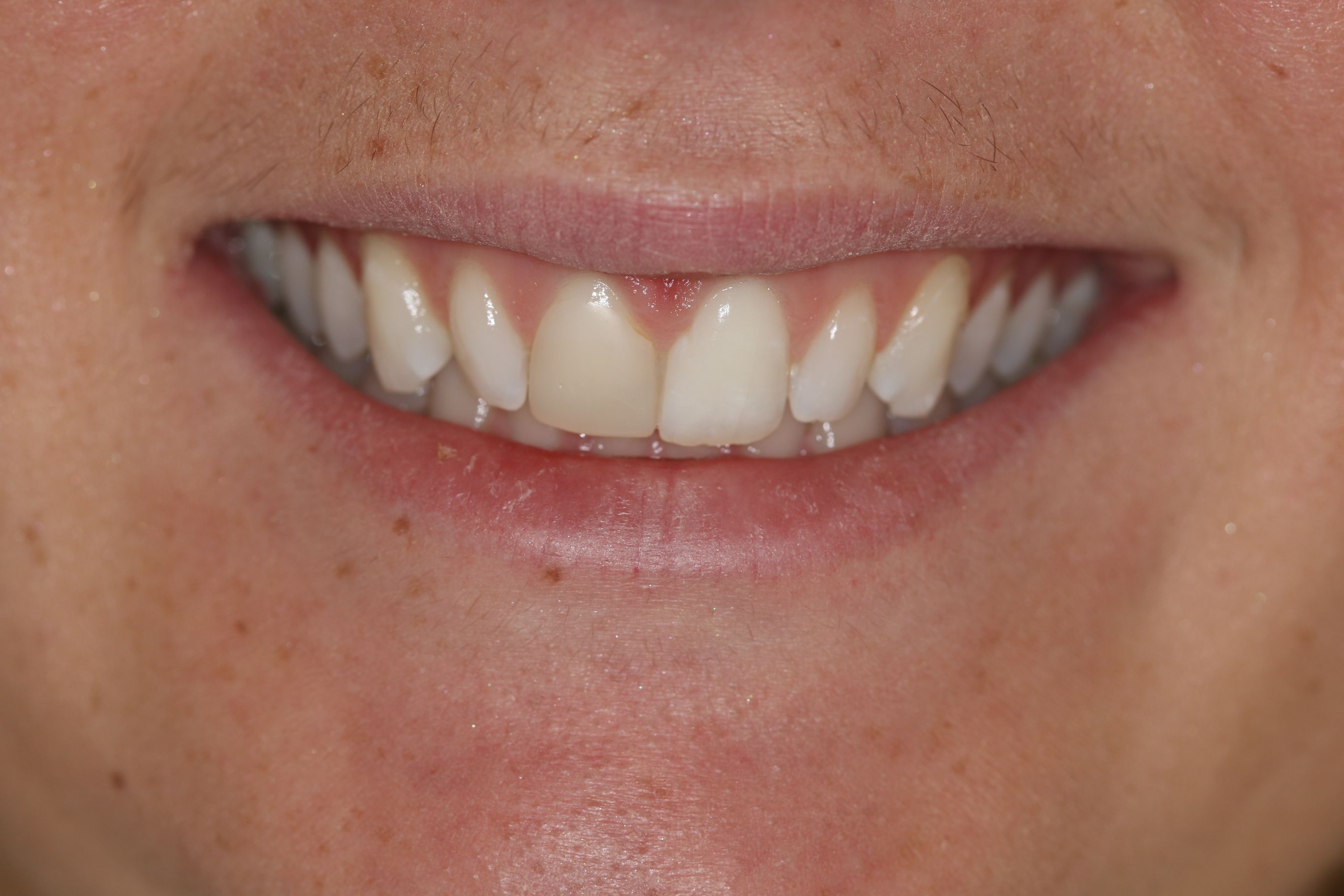 Georgetown Cosmetic Dentistry