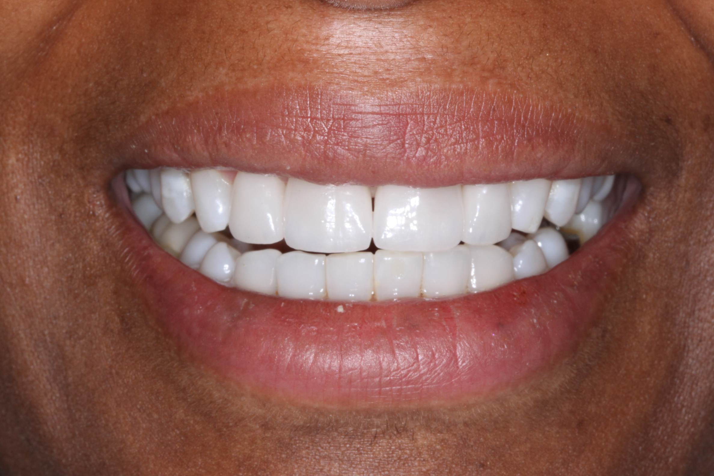 Georgetown Cosmetic Dentistry