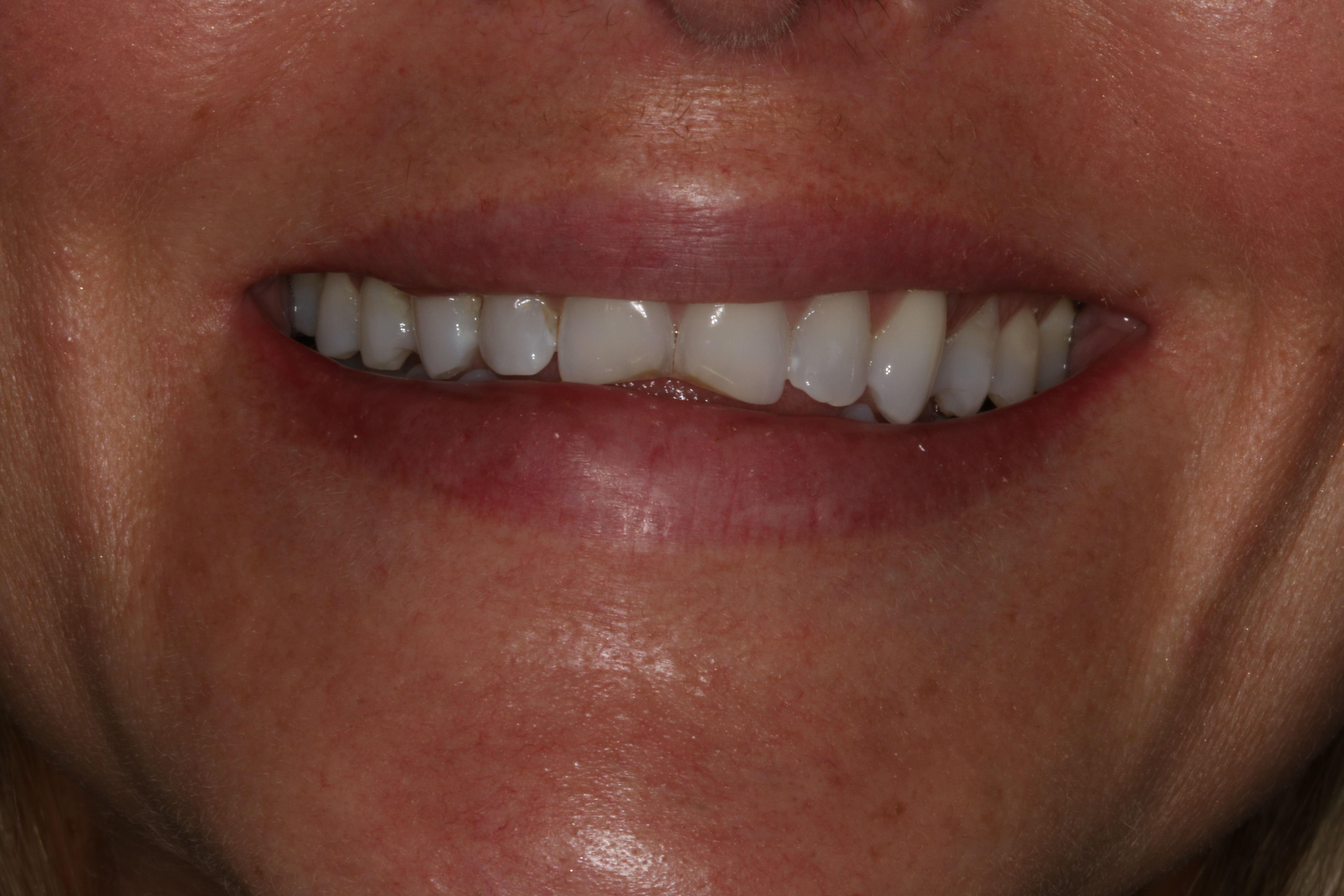 Georgetown Cosmetic Dentistry
