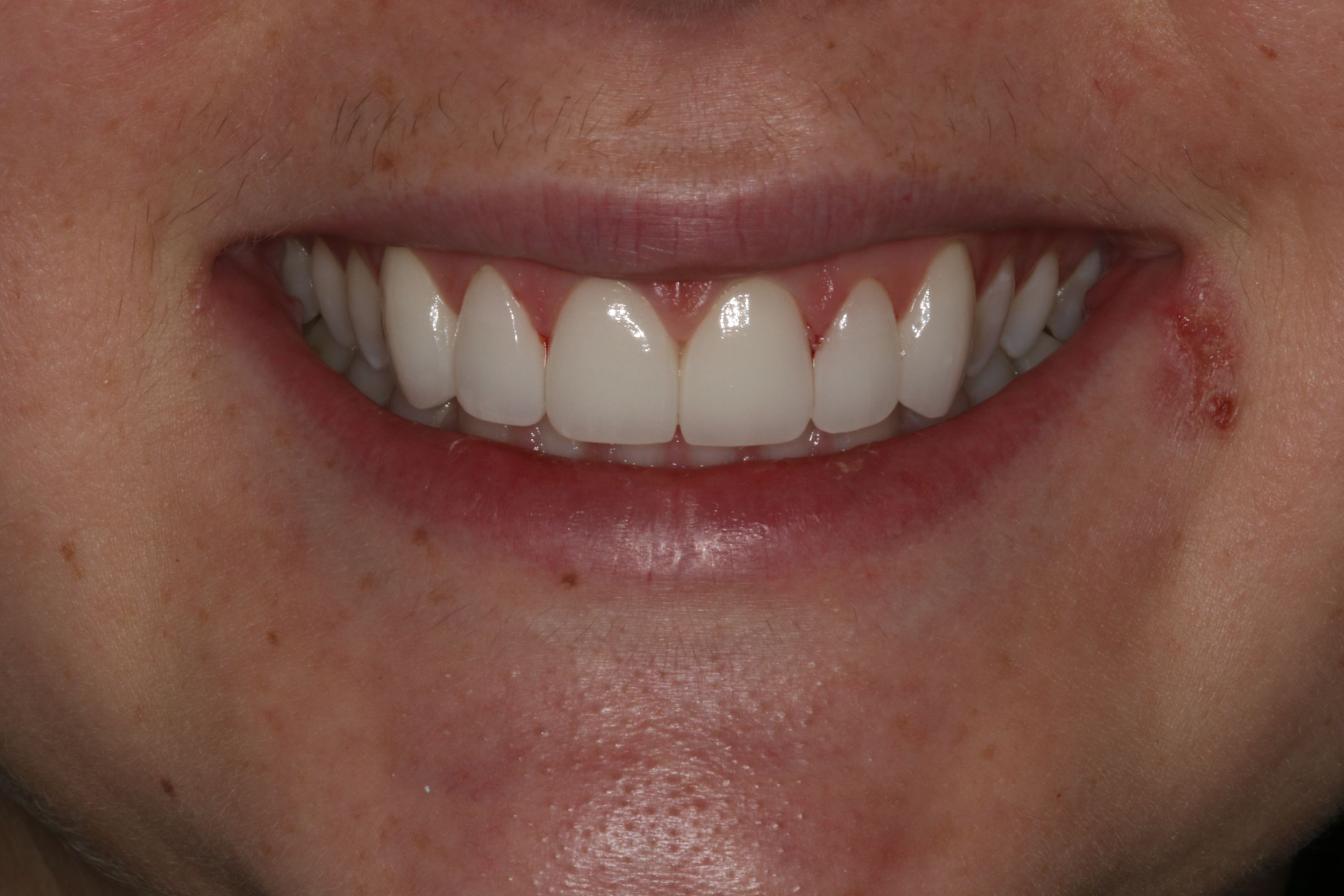 Georgetown Cosmetic Dentistry