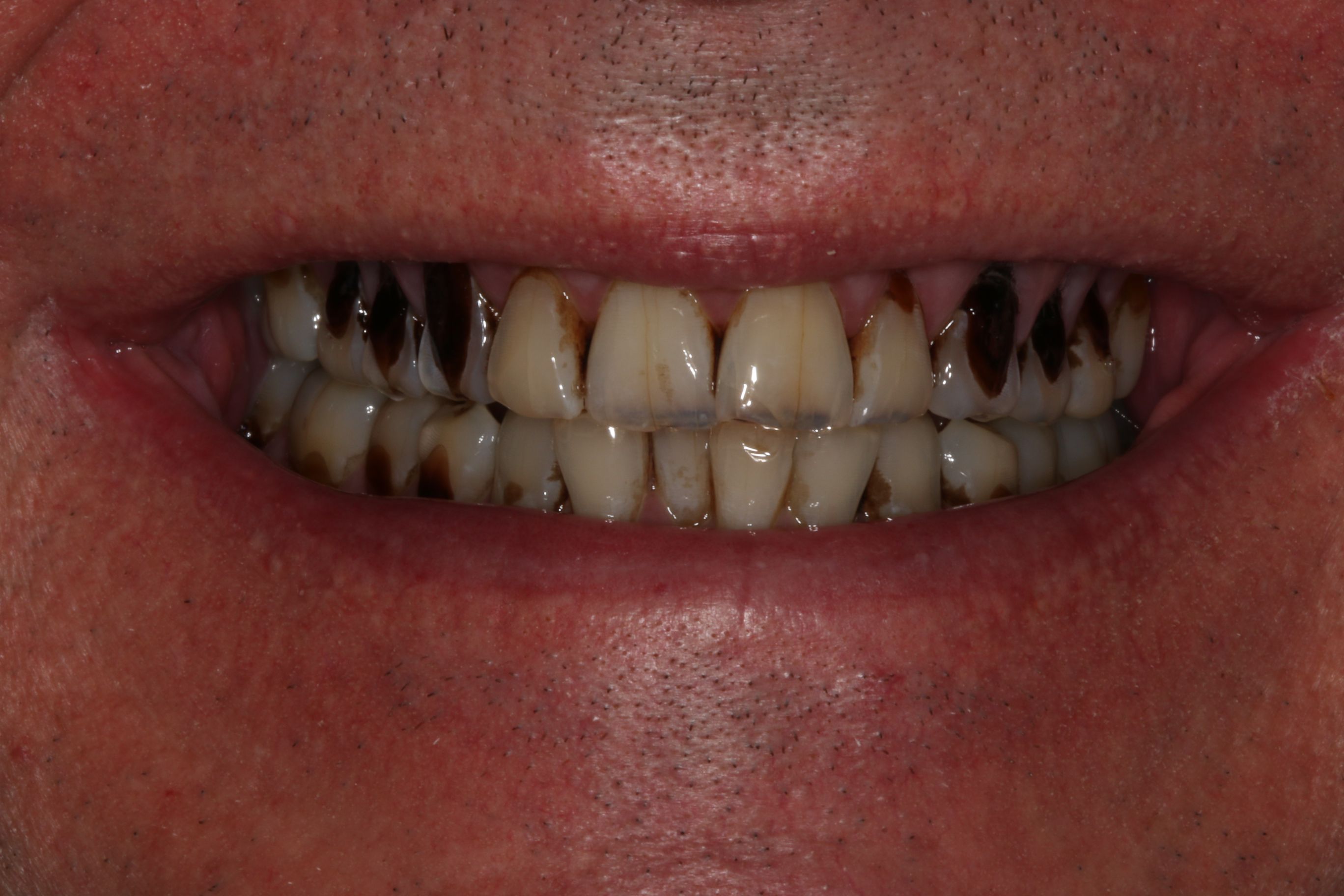 Georgetown Cosmetic Dentistry