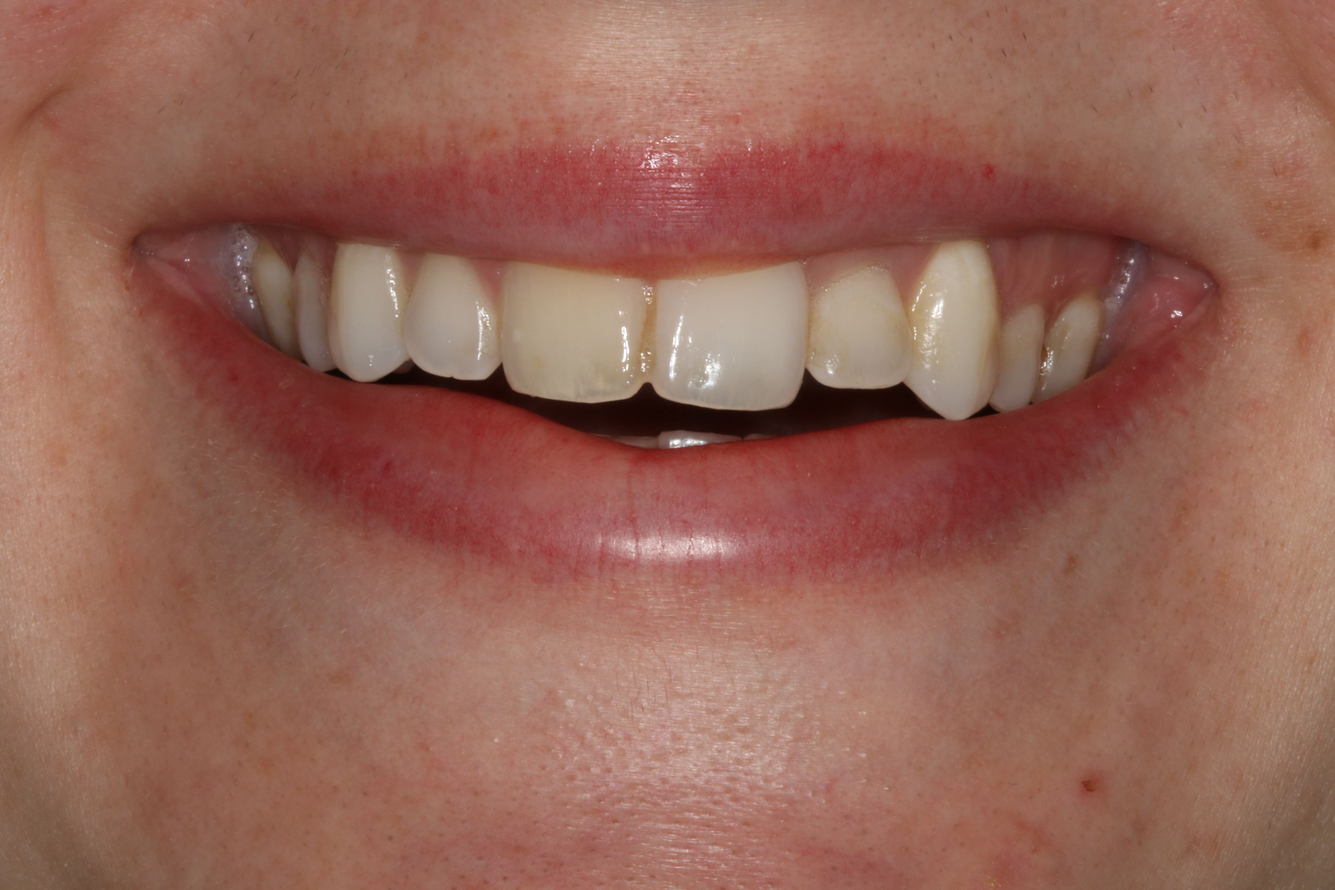 Georgetown Cosmetic Dentistry