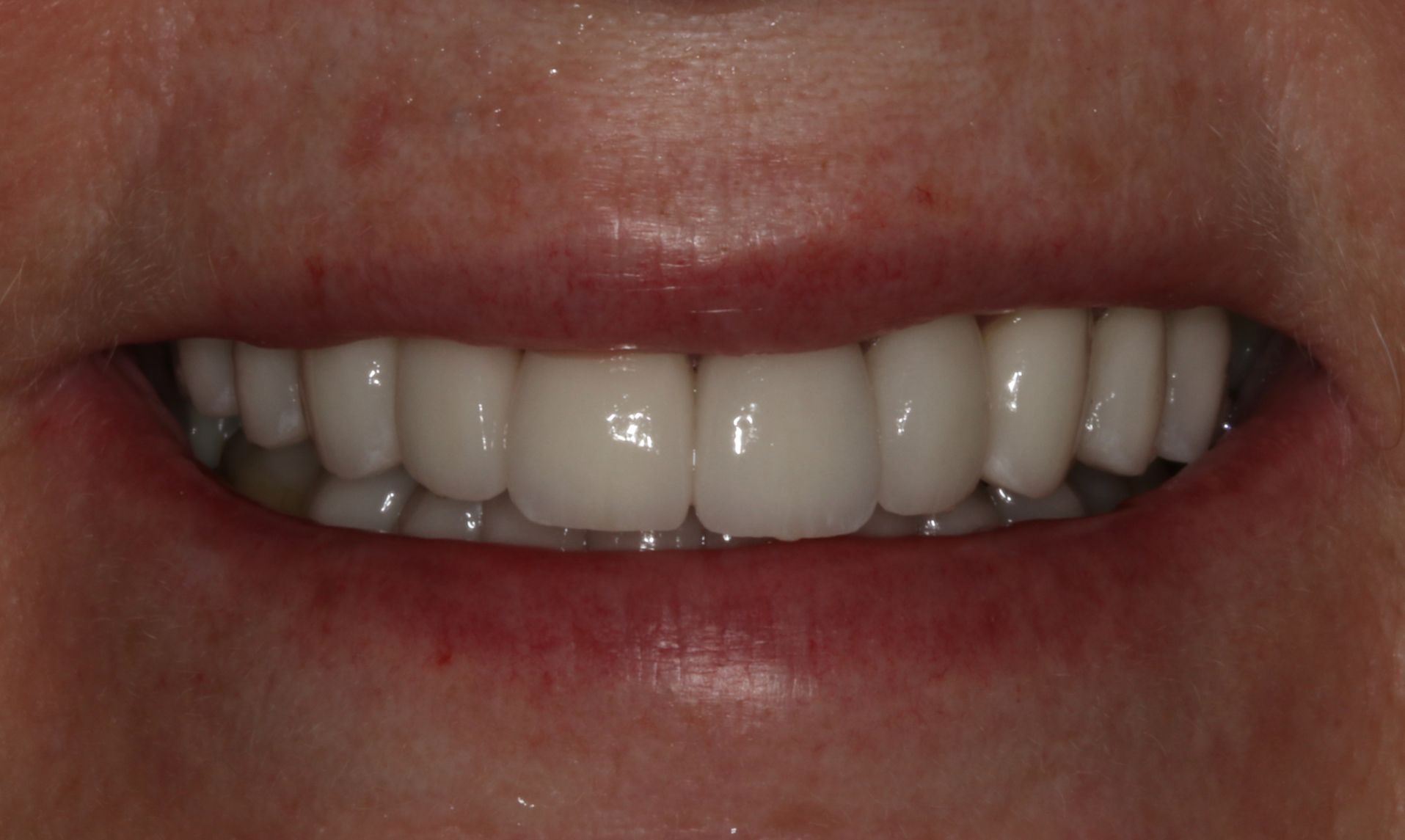 Georgetown Cosmetic Dentistry