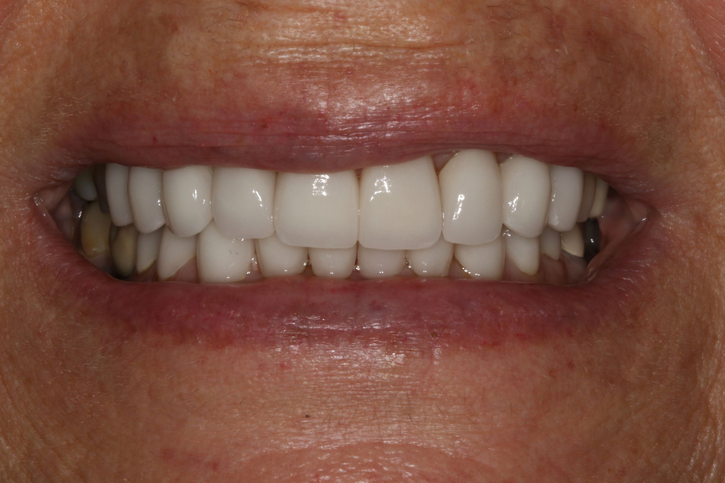 Georgetown Cosmetic Dentistry