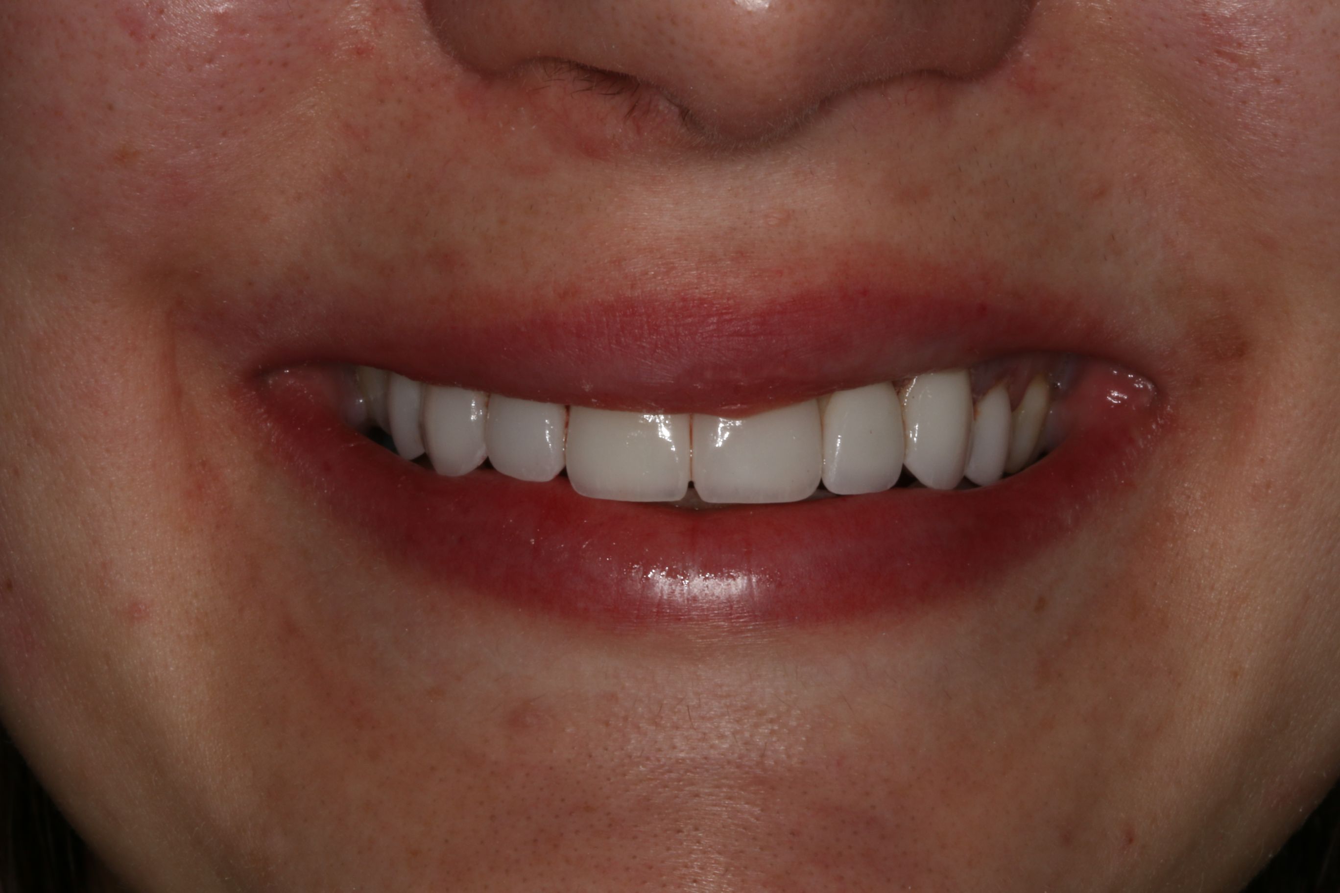 Georgetown Cosmetic Dentistry
