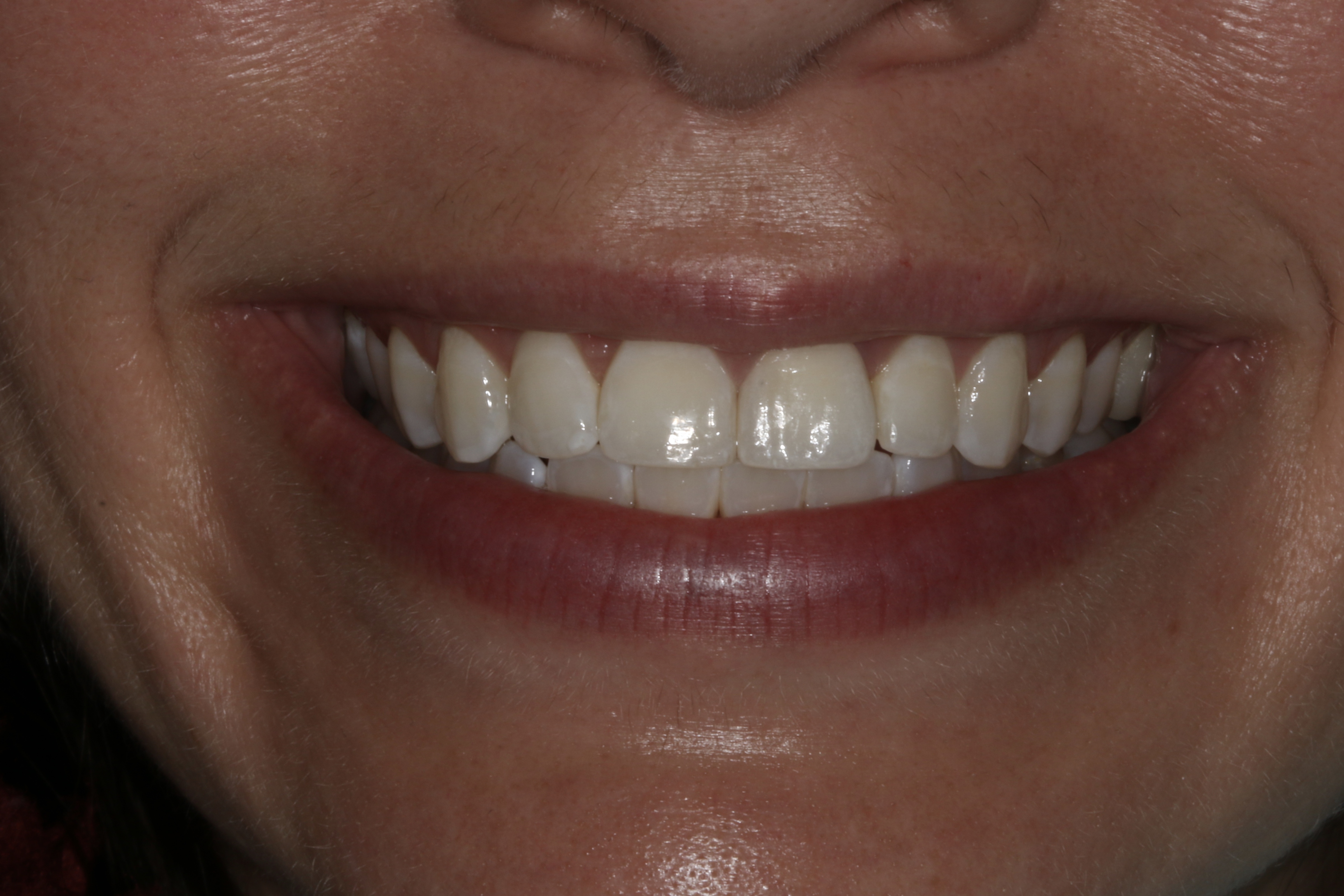 Georgetown Cosmetic Dentistry