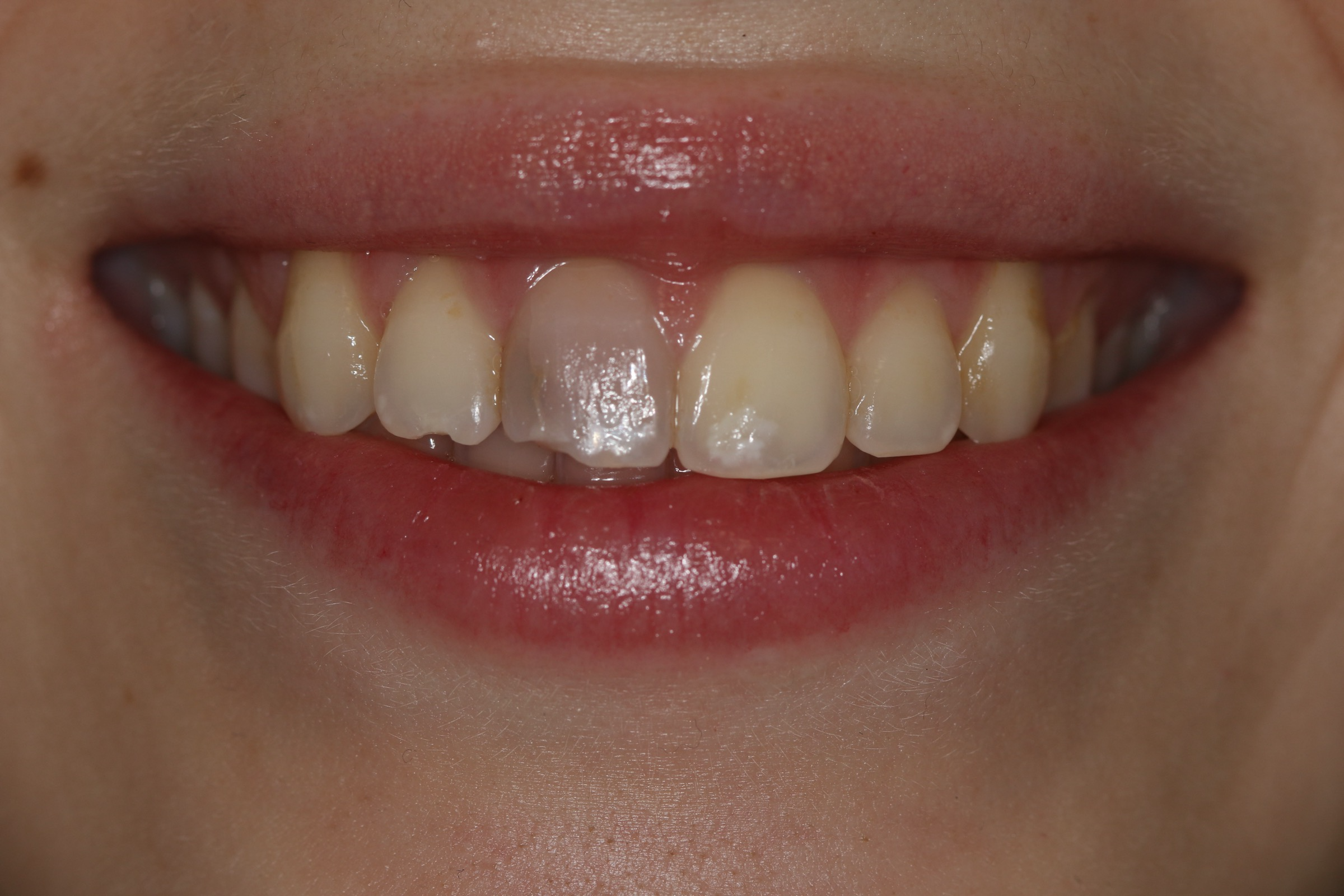 Georgetown Cosmetic Dentistry