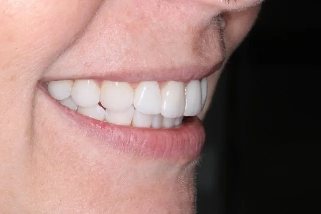 Georgetown Cosmetic Dentistry