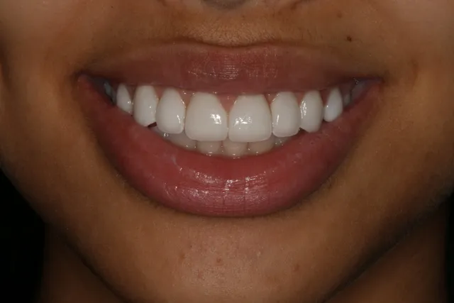 Georgetown Cosmetic Dentistry