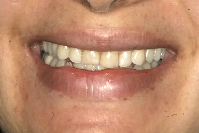 Georgetown Cosmetic Dentistry