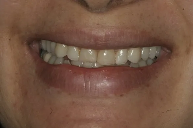 Georgetown Cosmetic Dentistry