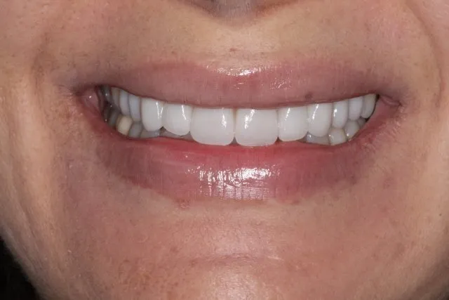 Georgetown Cosmetic Dentistry