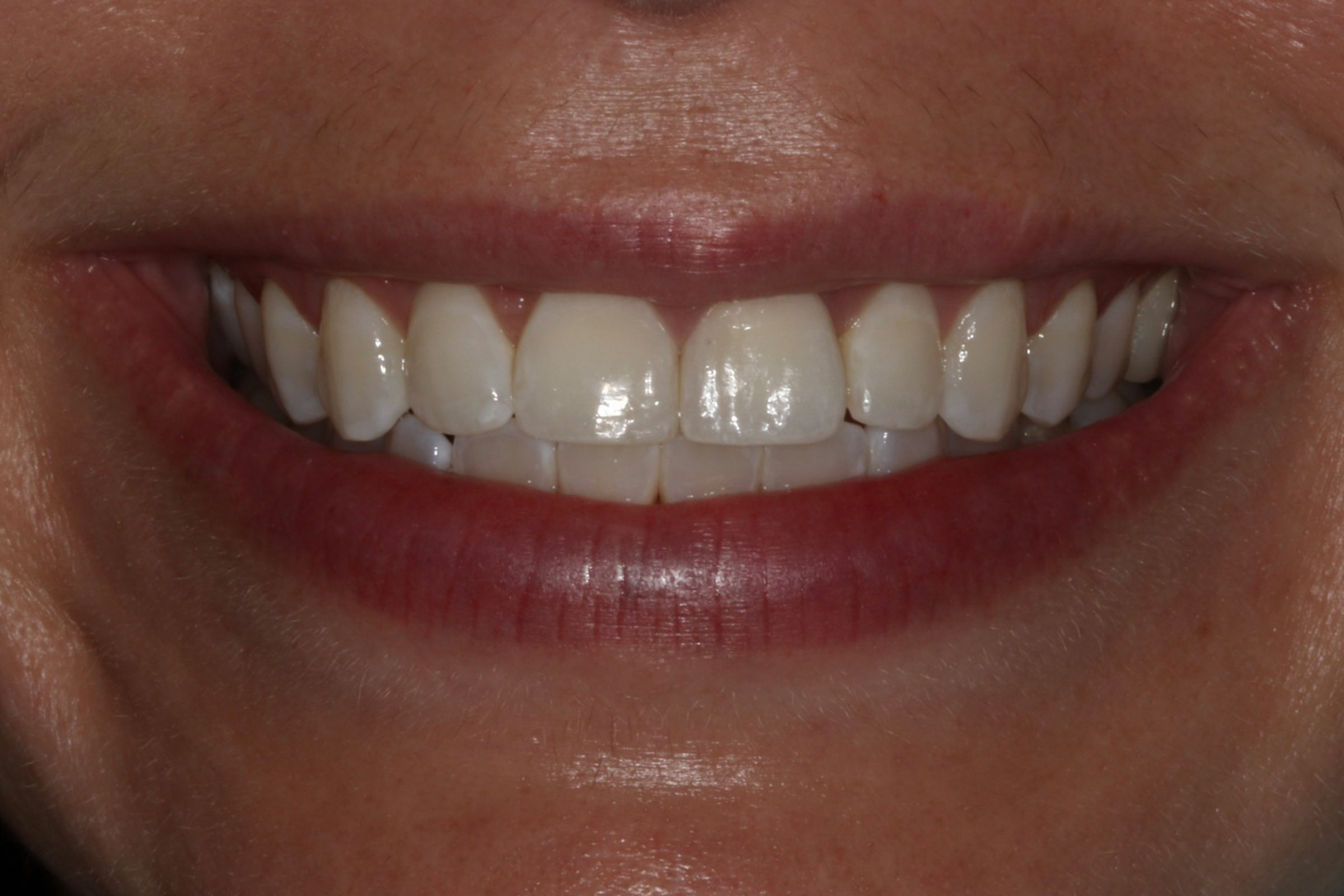 Georgetown Cosmetic Dentistry