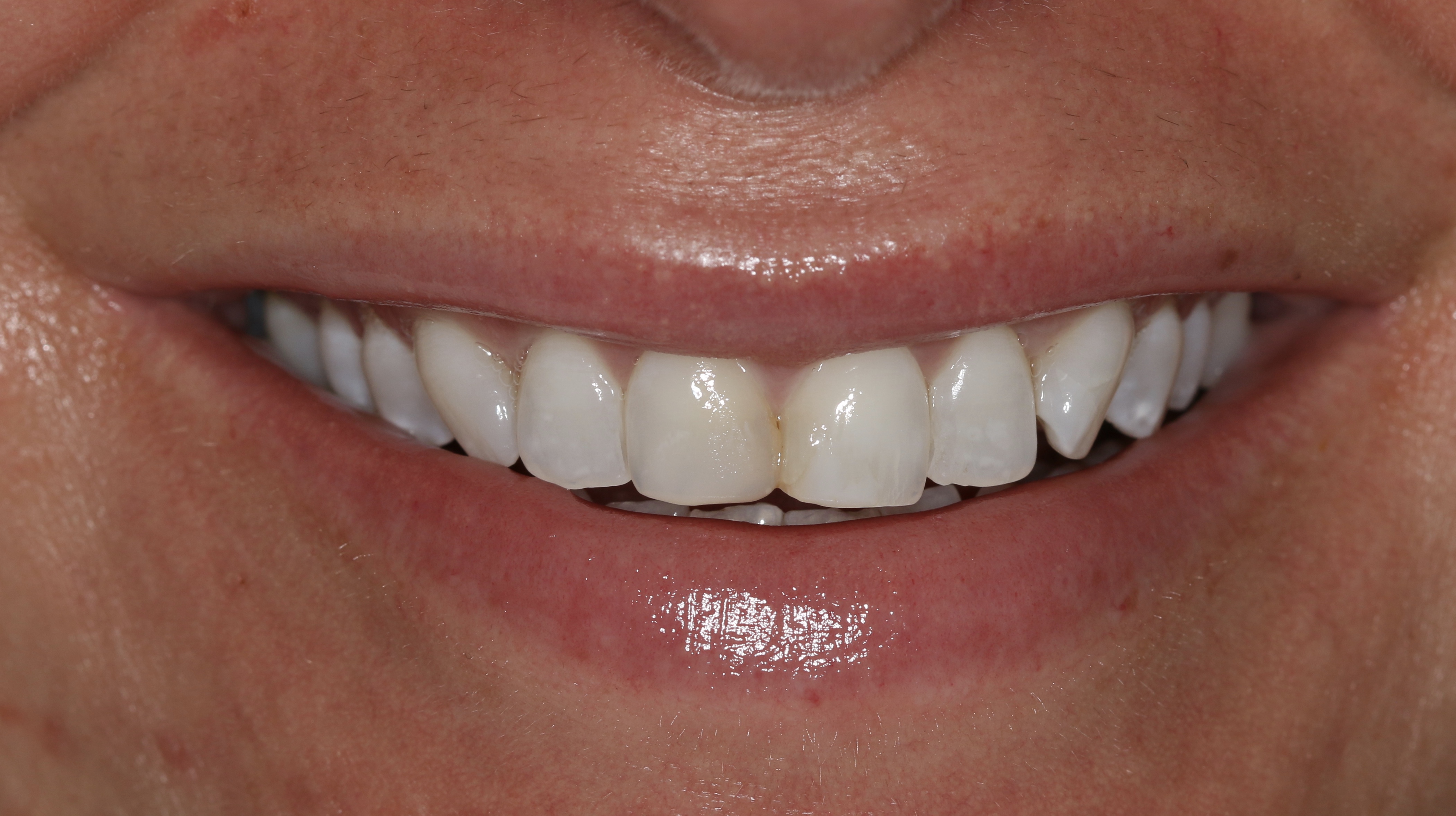 Georgetown Cosmetic Dentistry
