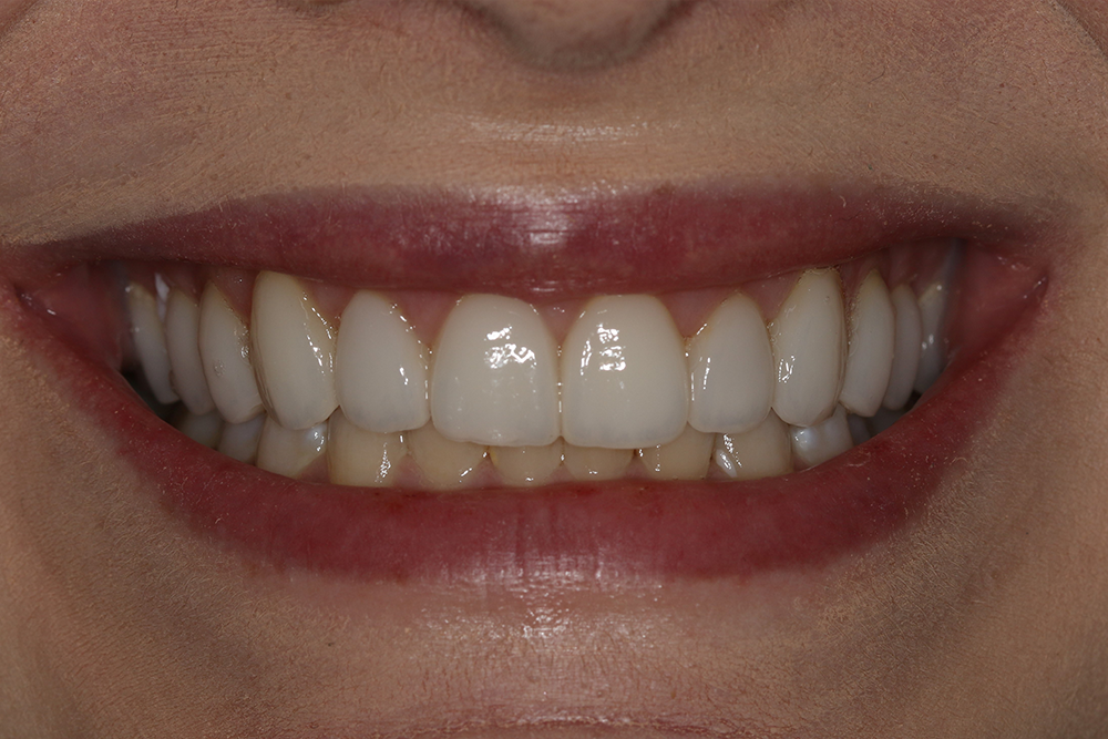 Georgetown Cosmetic Dentistry