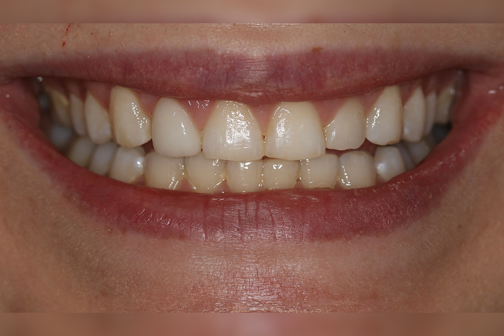 Georgetown Cosmetic Dentistry