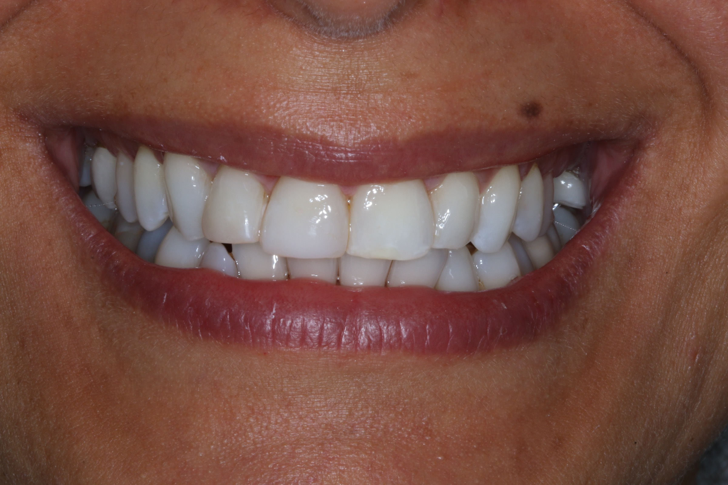 Georgetown Cosmetic Dentistry