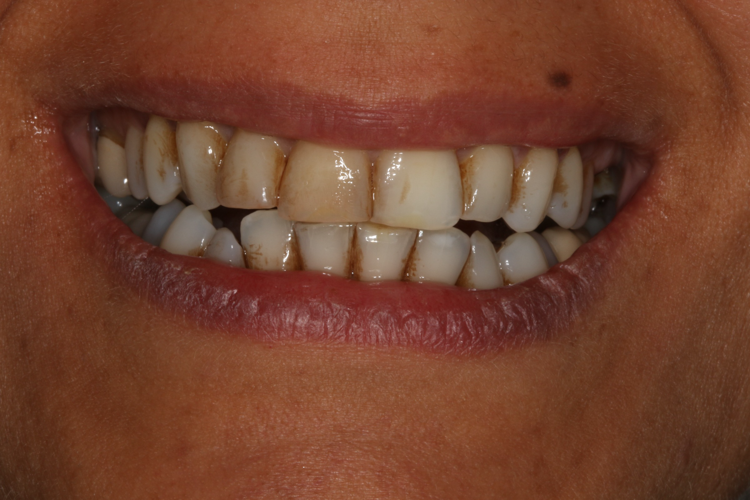 Georgetown Cosmetic Dentistry